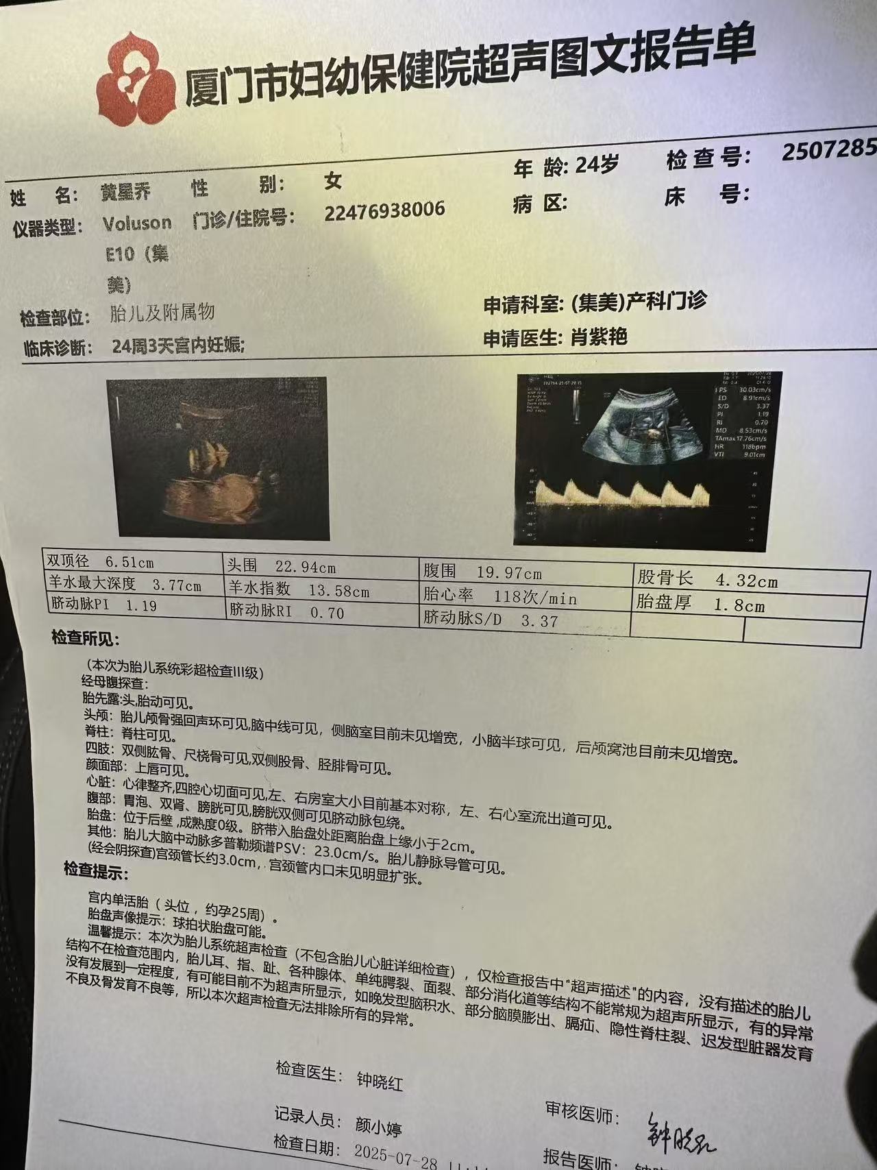 孕期大排畸检查选择二维还是四维？