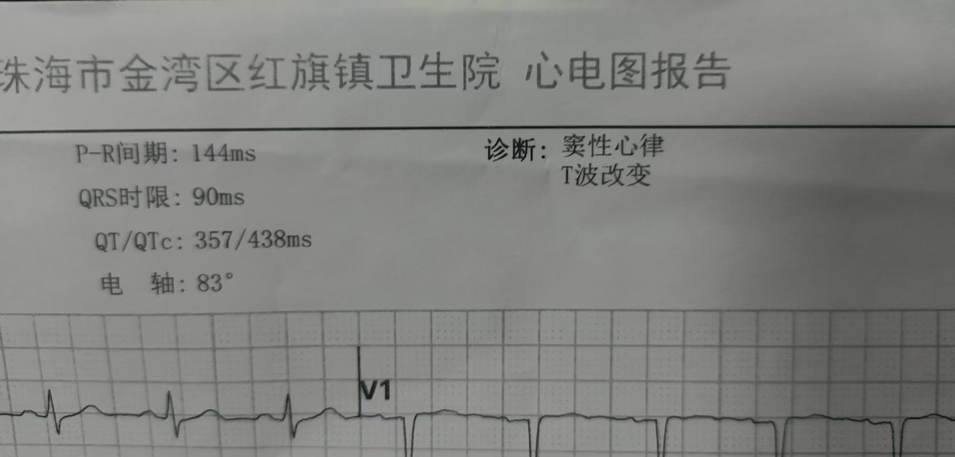 孕期缺氧困扰
