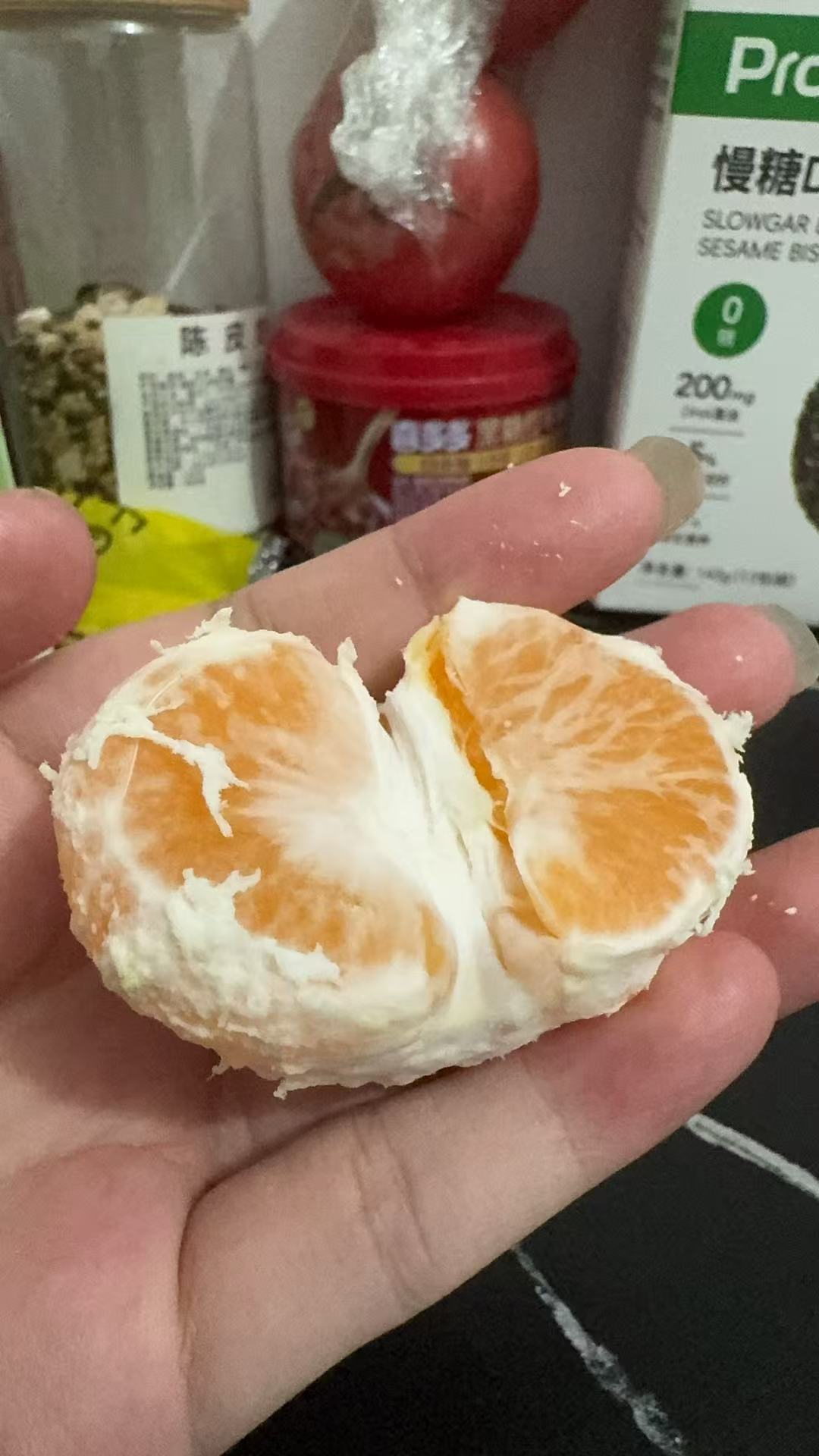 孕期糖耐检查经验分享