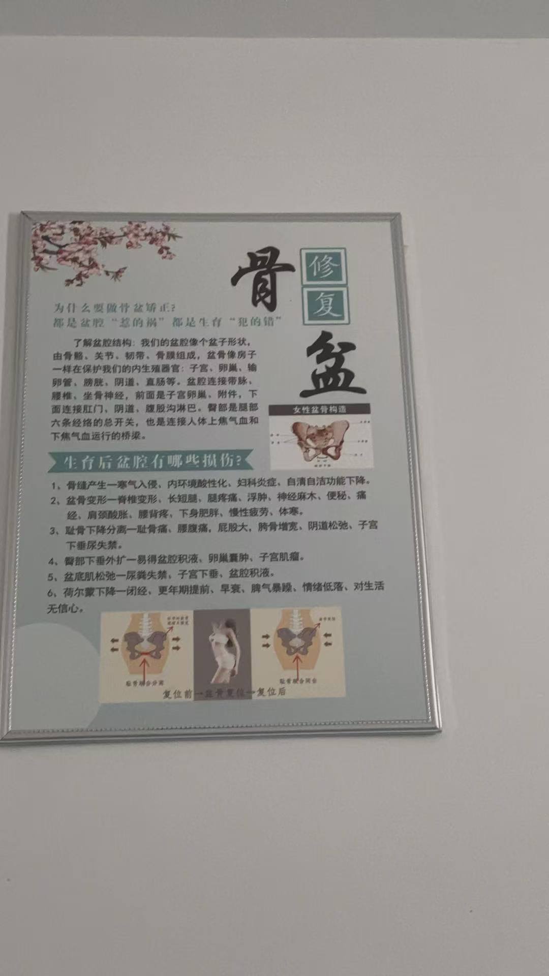 产后修复有必要做吗？