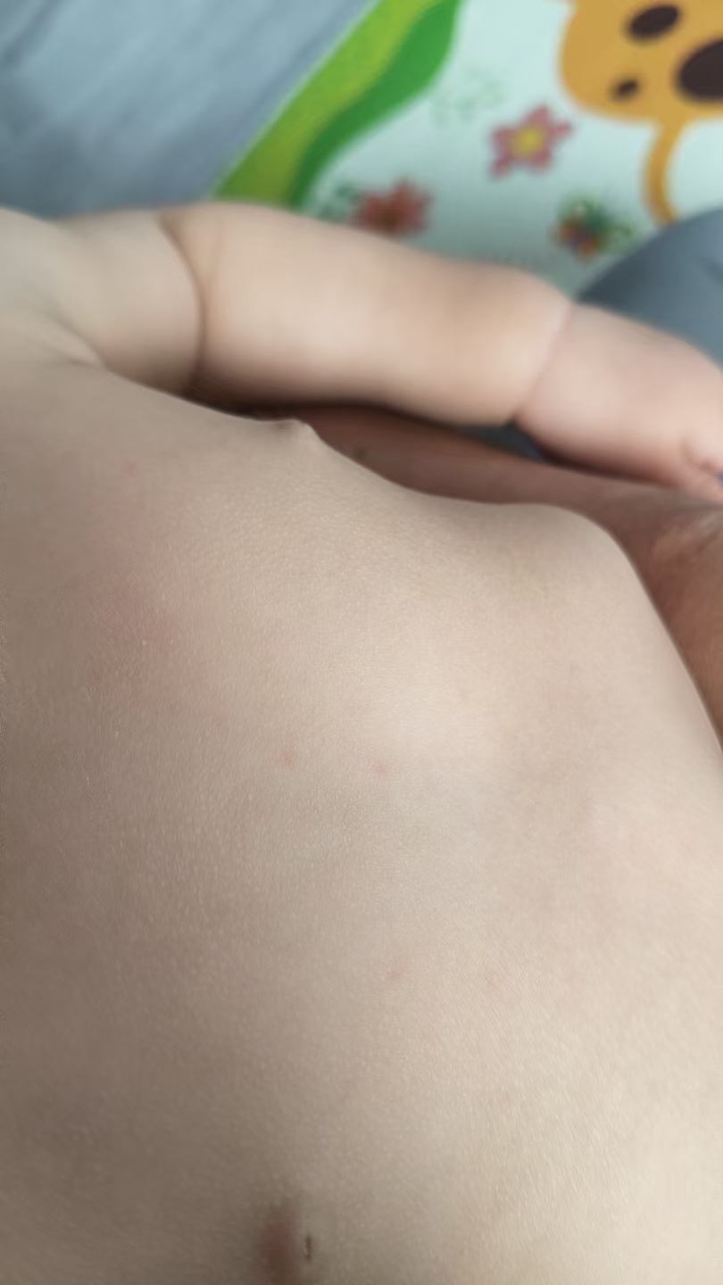 宝宝发烧和出疹子怎么办