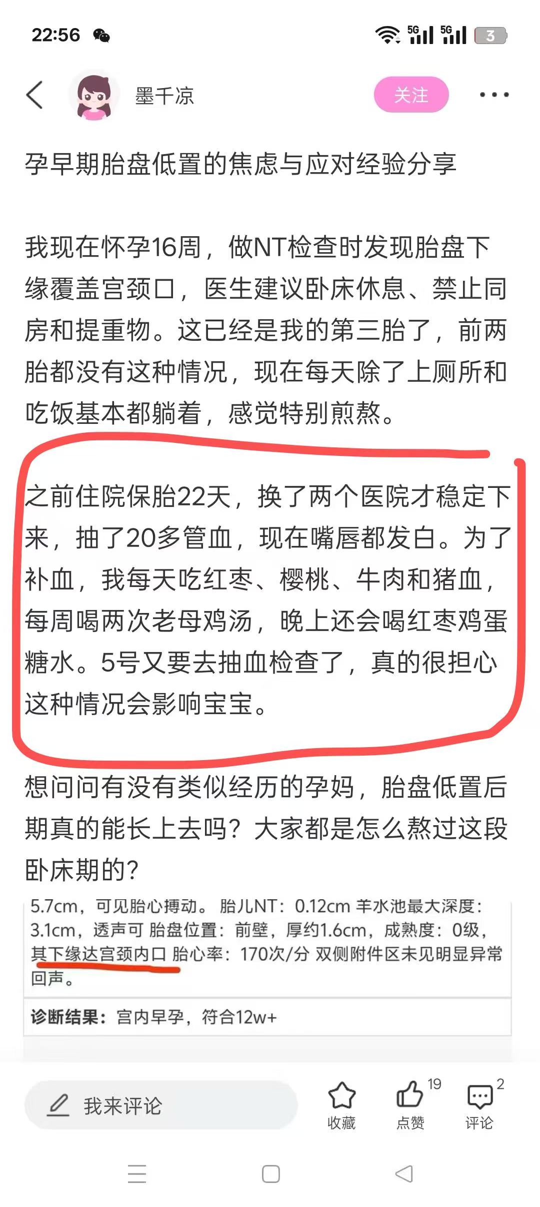 孕妈们的胎心仪使用心得