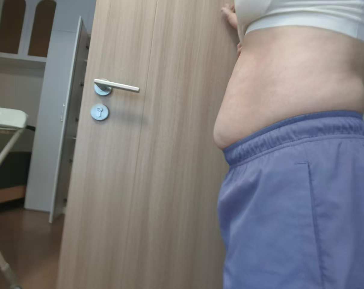 产后肚子下垂的烦恼