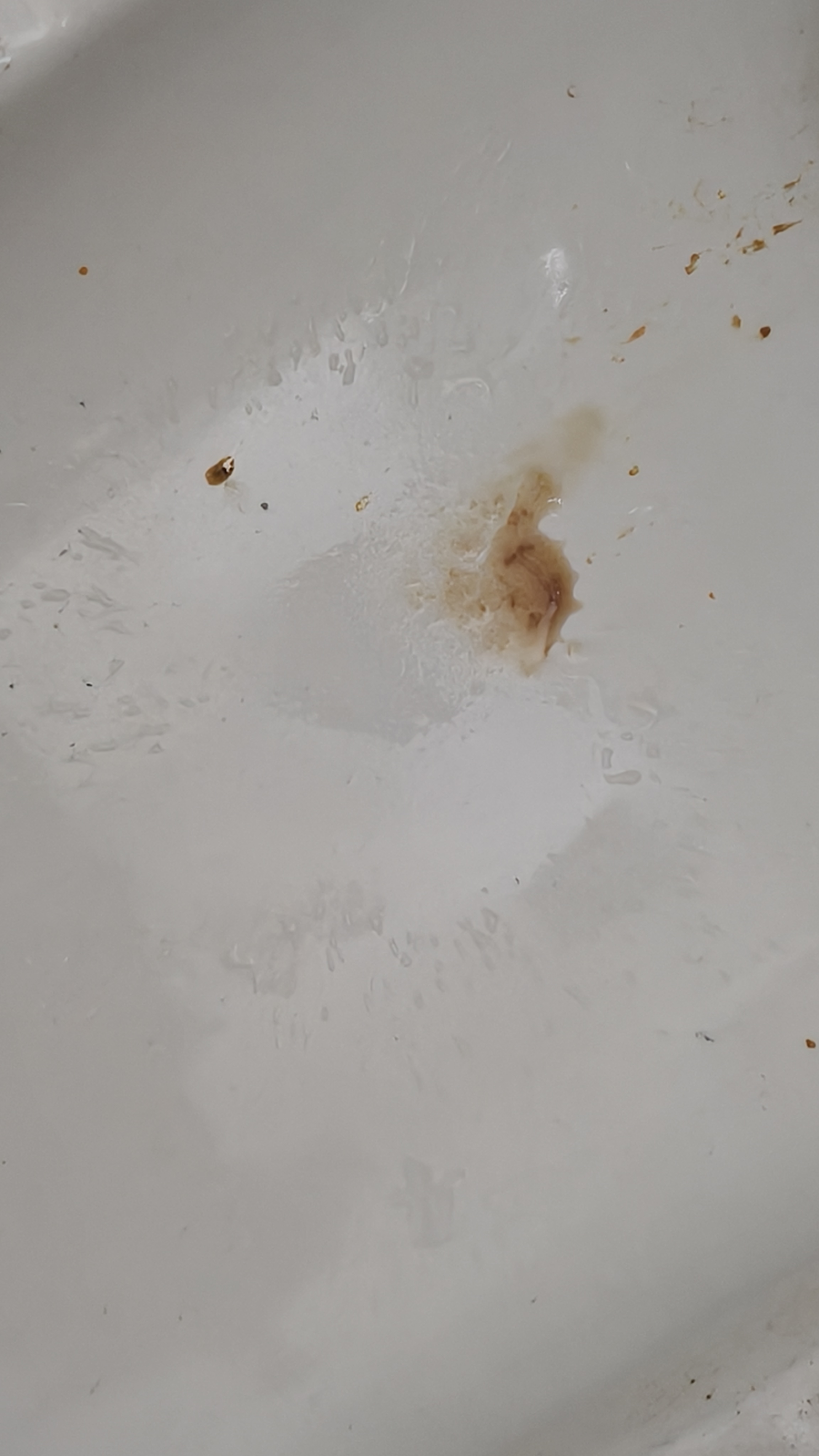 孕期腹痛出血紧急就医经历