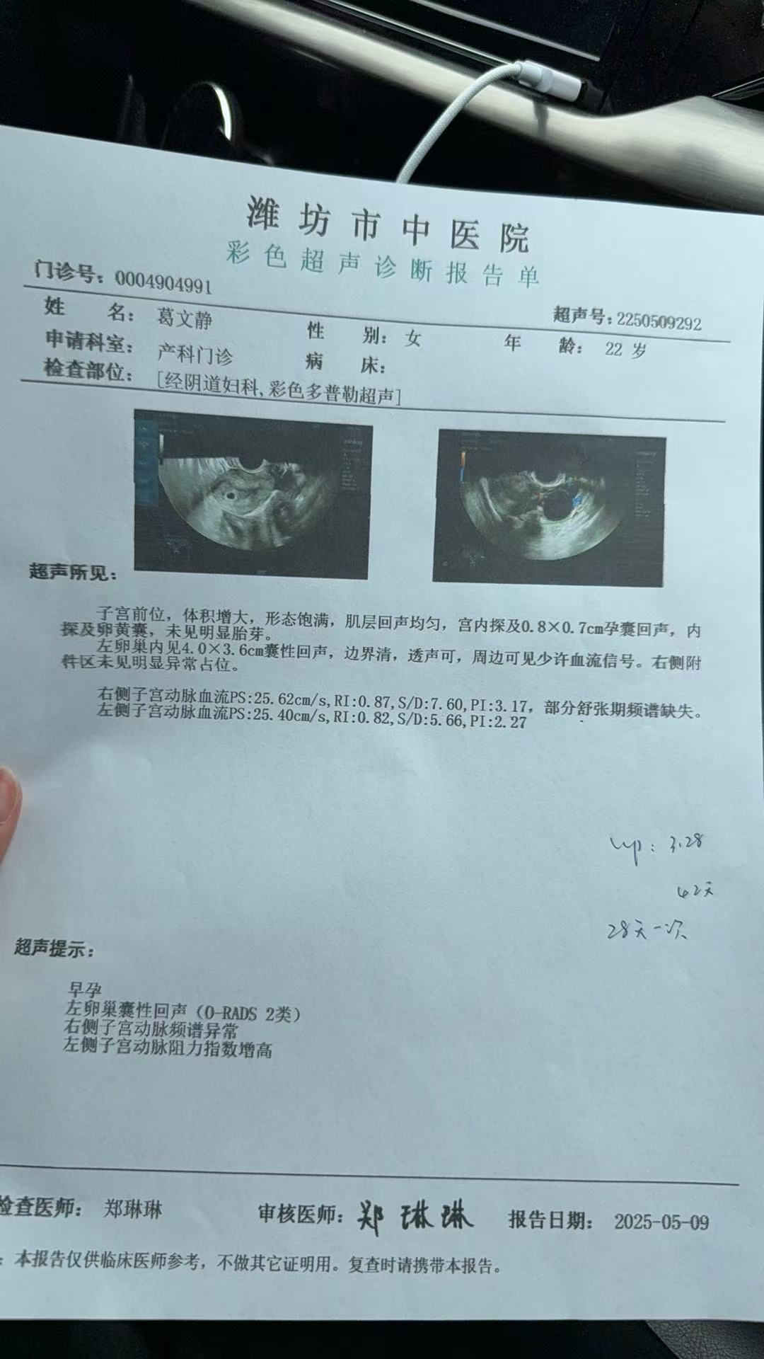 孕期检查分享