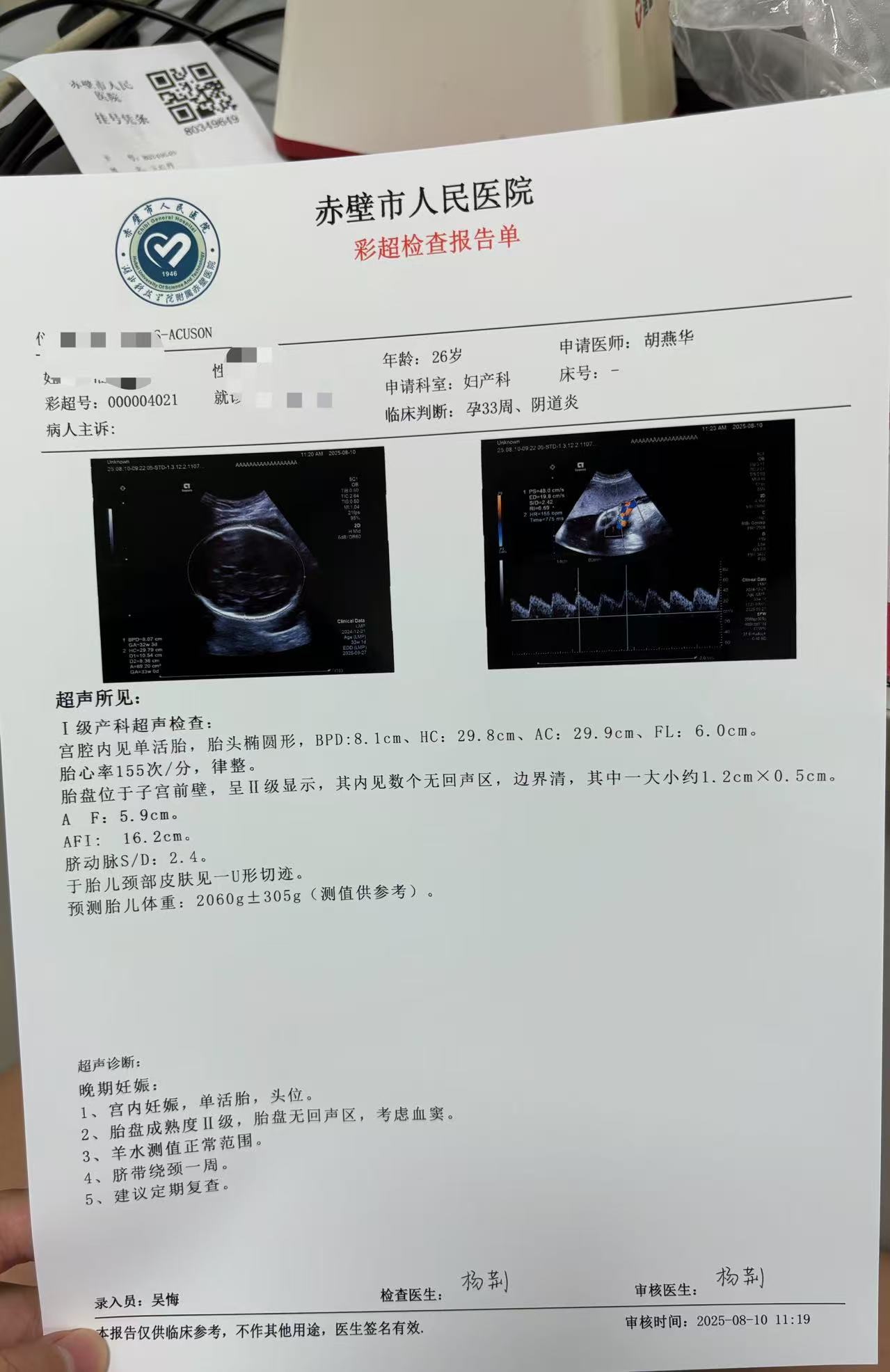 胎监不配合的烦恼