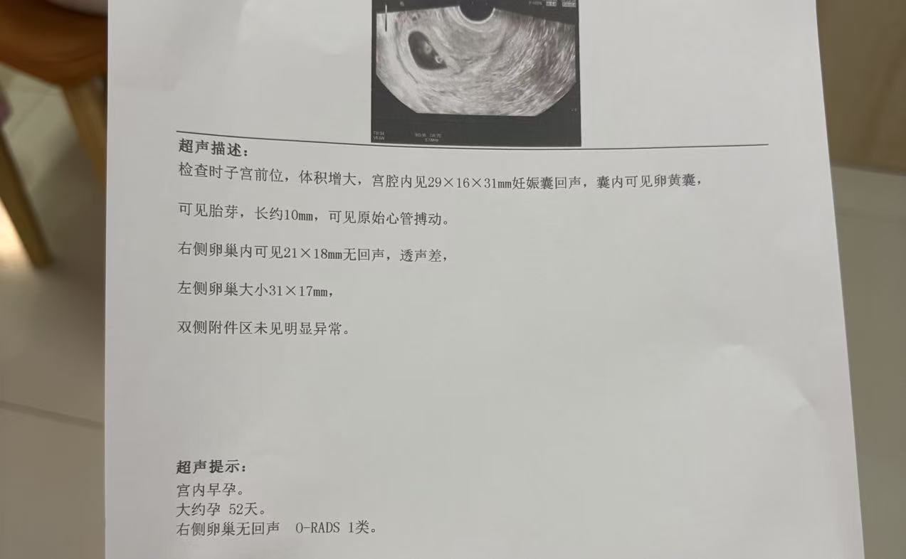 孕期褐色分泌物让人焦虑