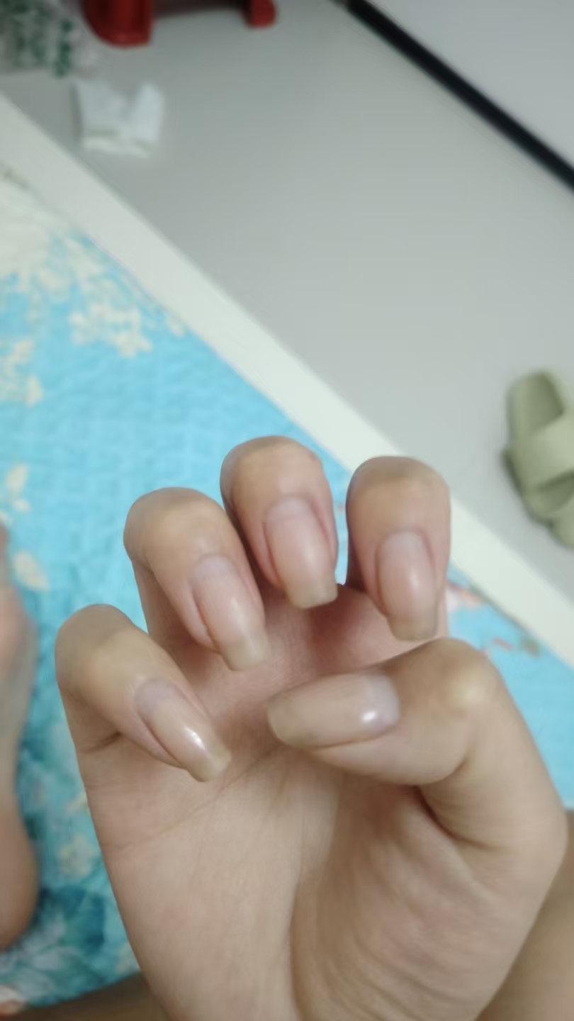 孕期孕吐反应又加重了
