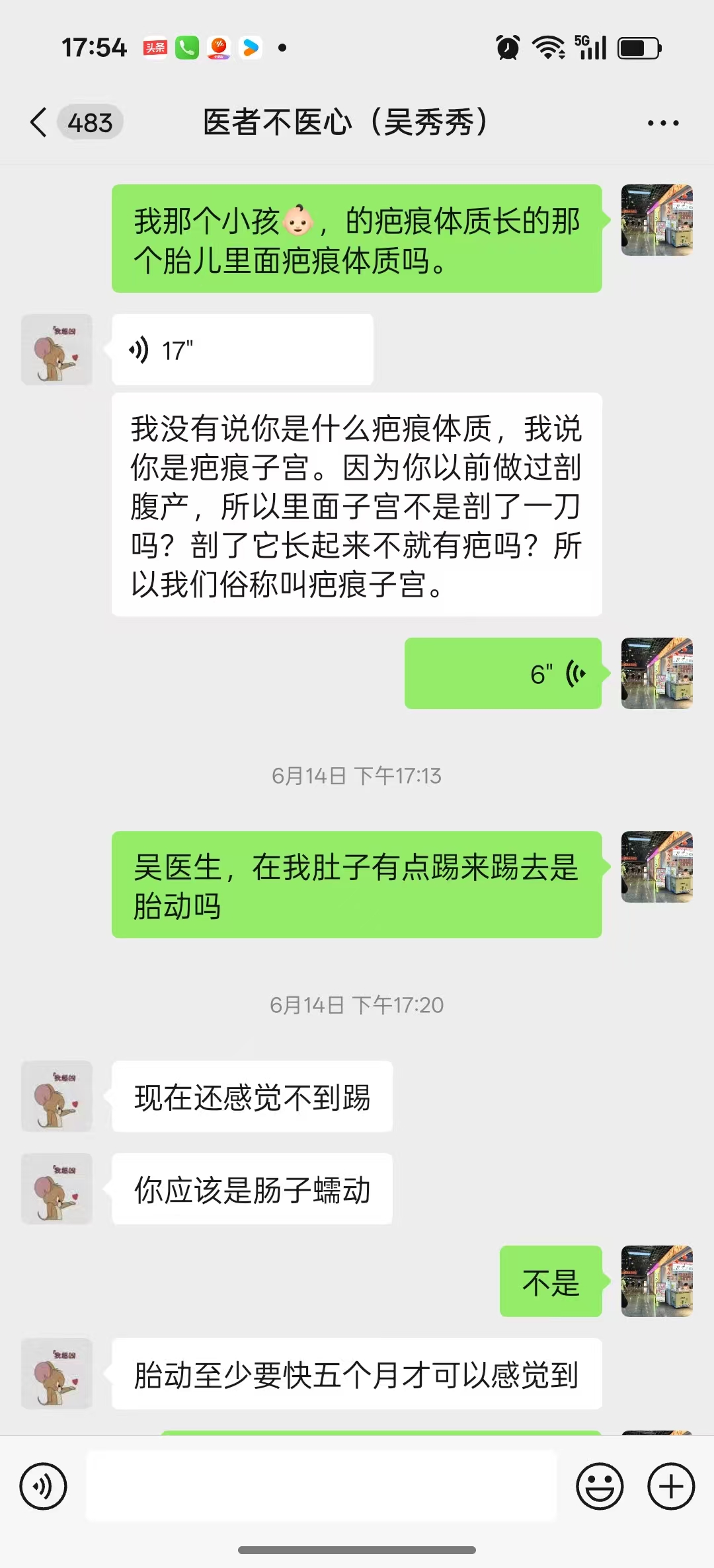剖腹产后的二胎选择与担忧