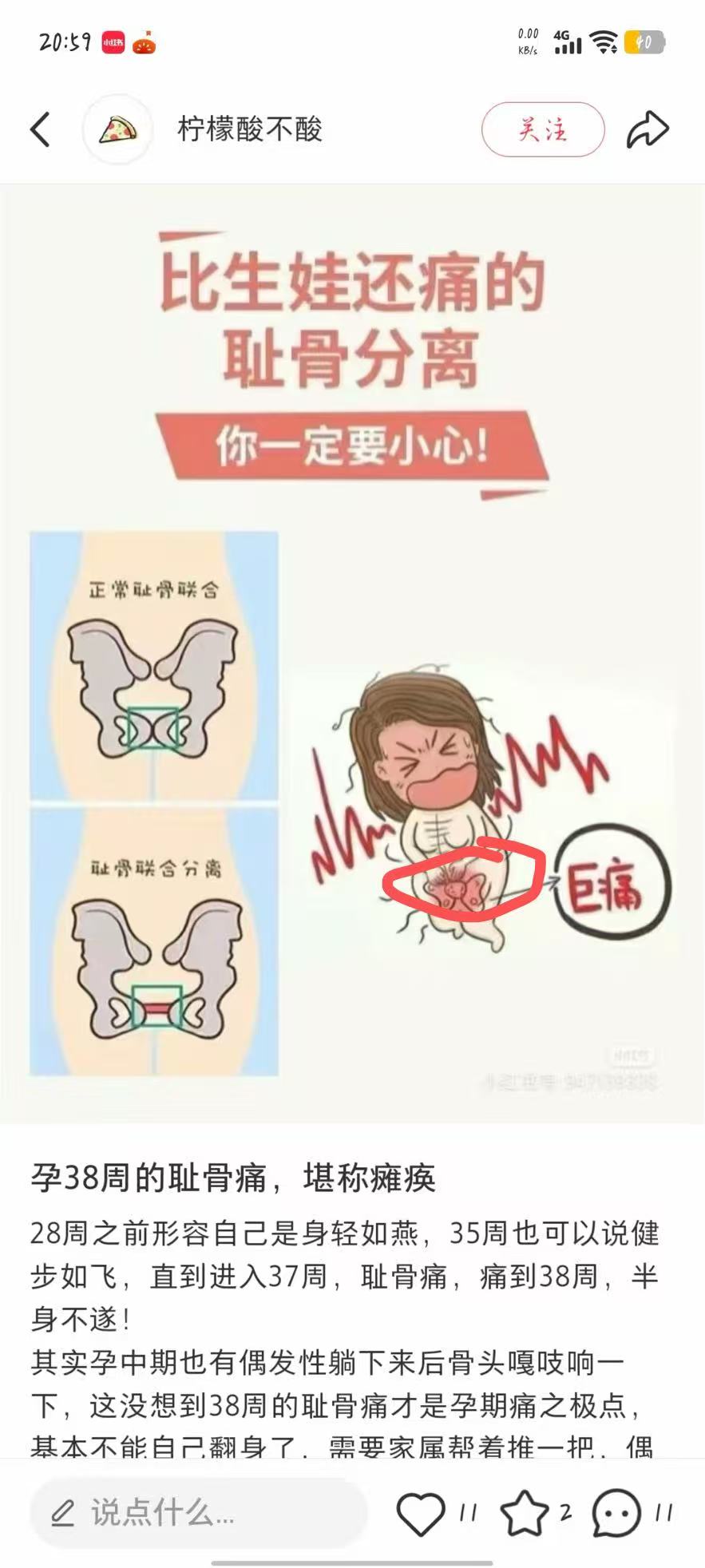 孕晚期耻骨疼痛难忍，姐妹们有什么缓解方法吗？
