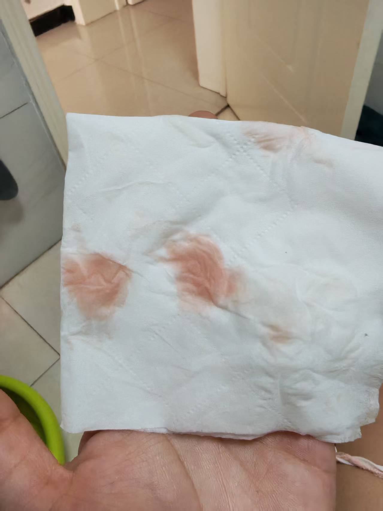 孕早期见红保胎经验分享