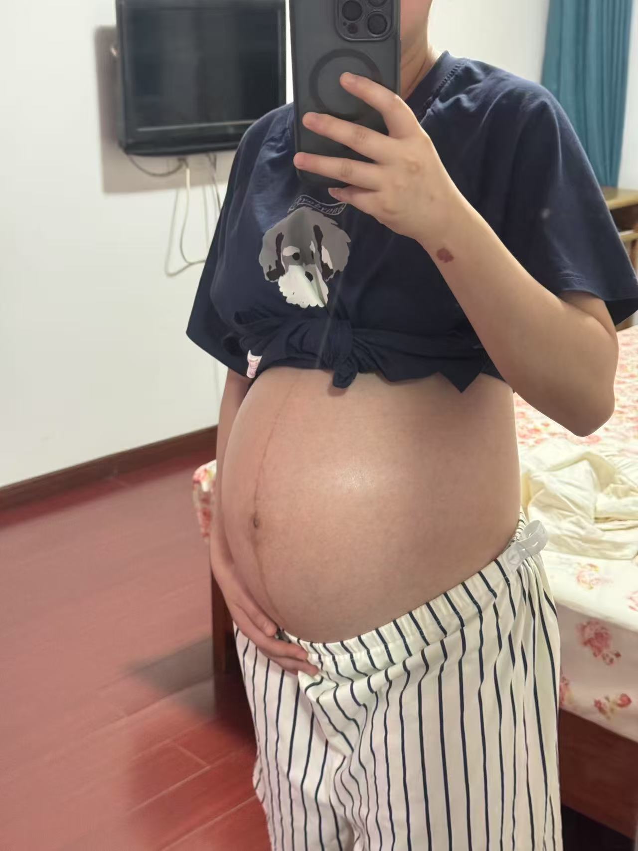 孕期肚子偏大但宝宝正常？孕晚期肚子大小之谜