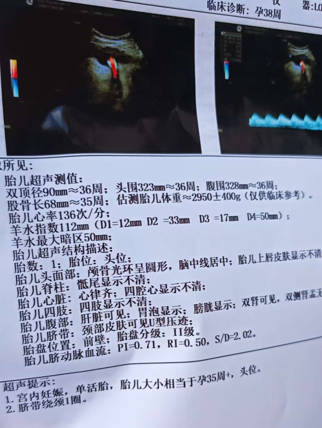 孕晚期彩超体重预估差异大，宝宝偏小怎么办？
