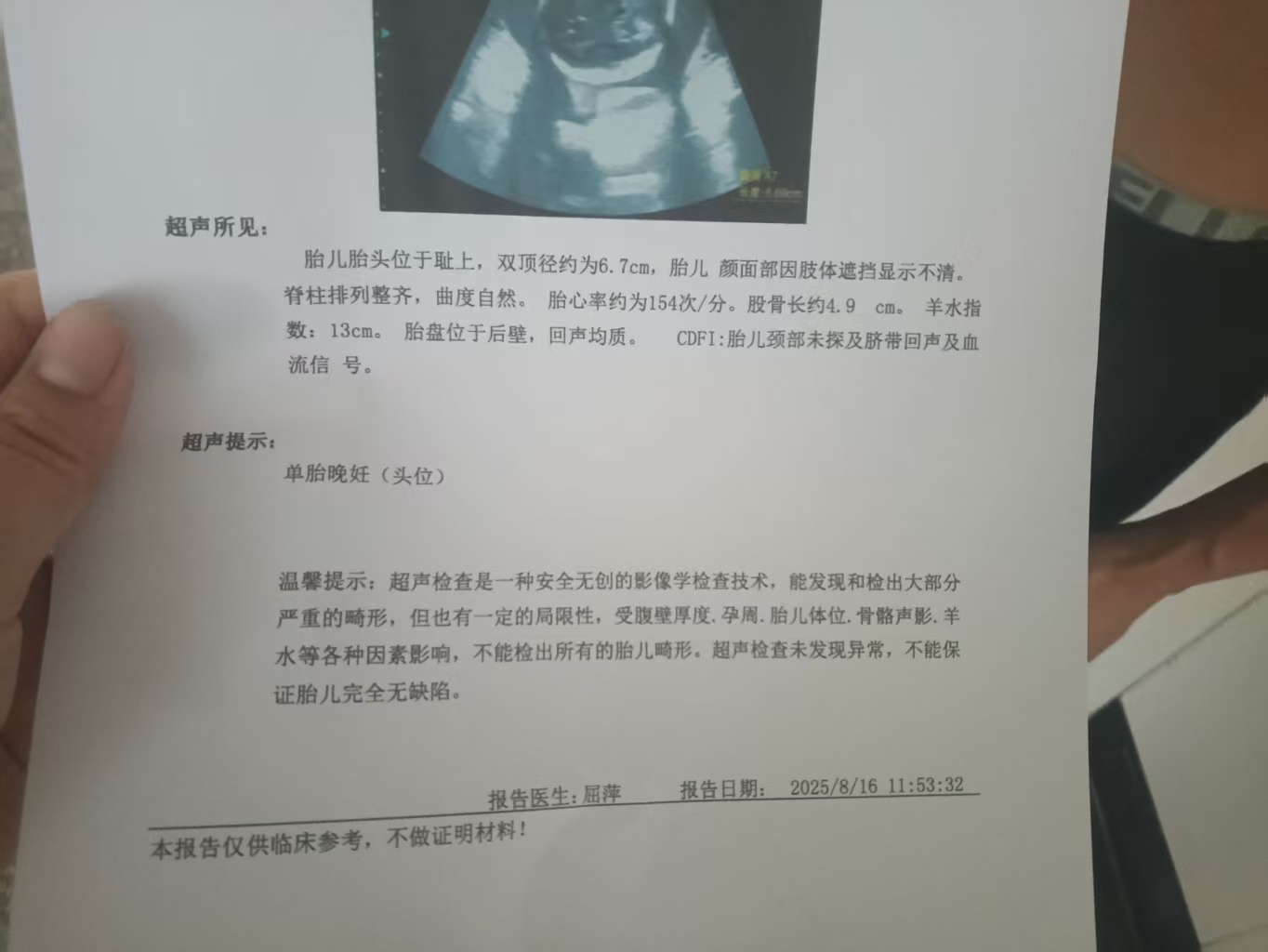 孕期血糖控制与饮食分享