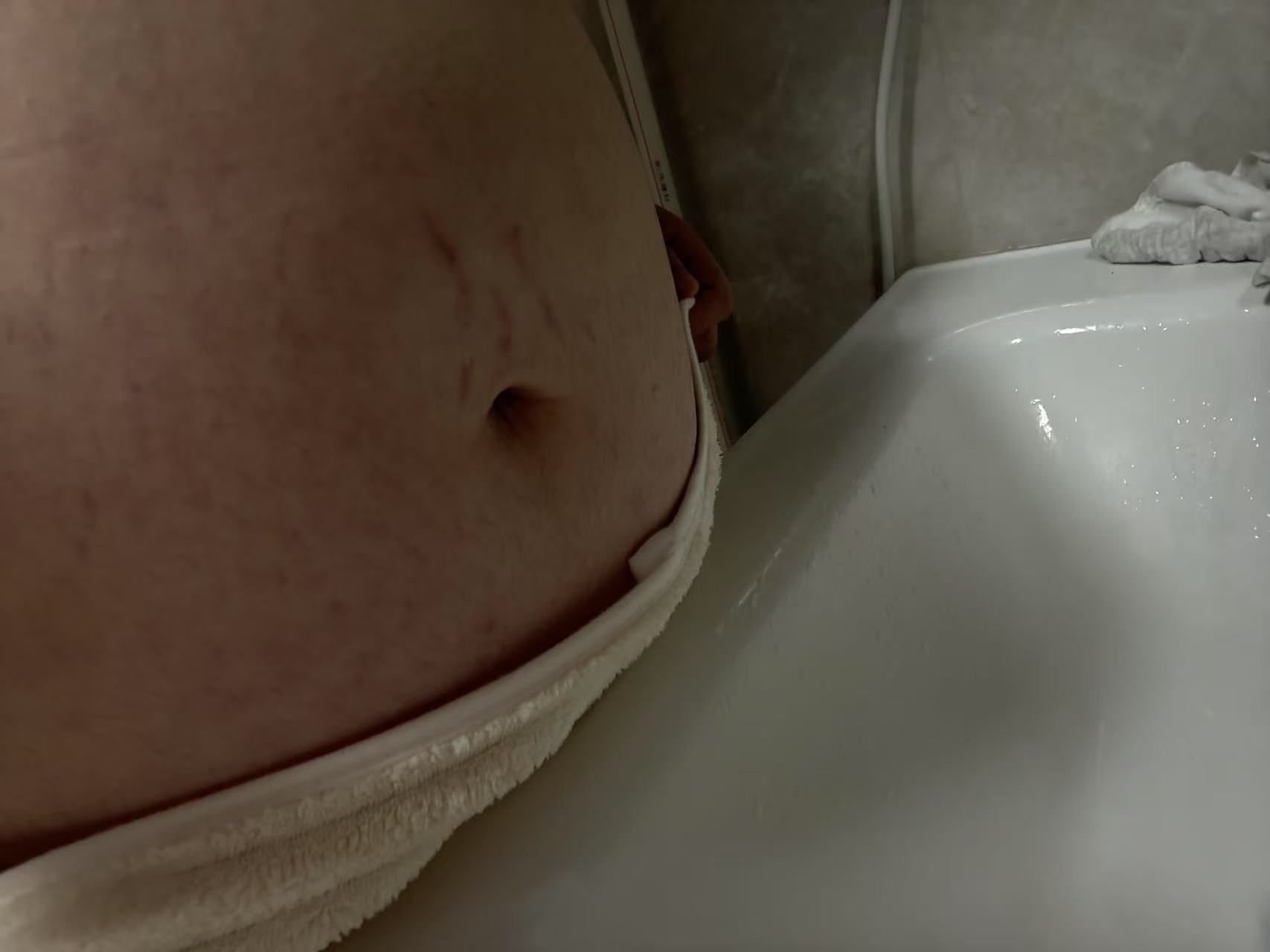 孕晚期突然发现妊娠纹的崩溃瞬间