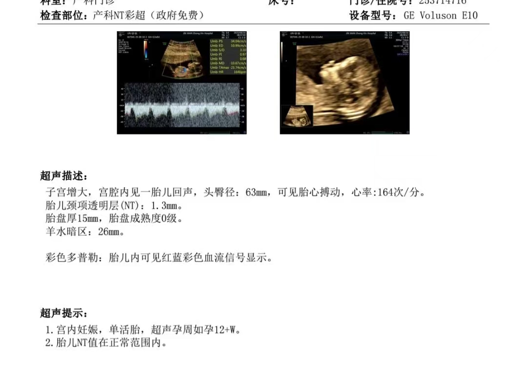 孕期同房经验分享
