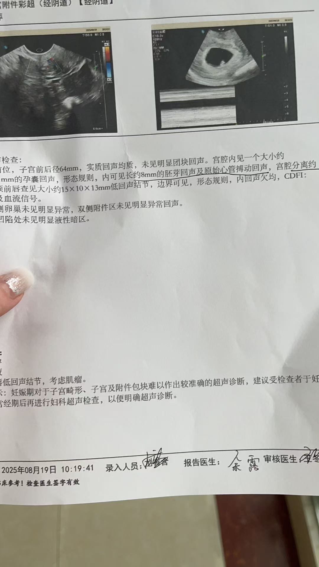 七周B超检查胎心胎芽