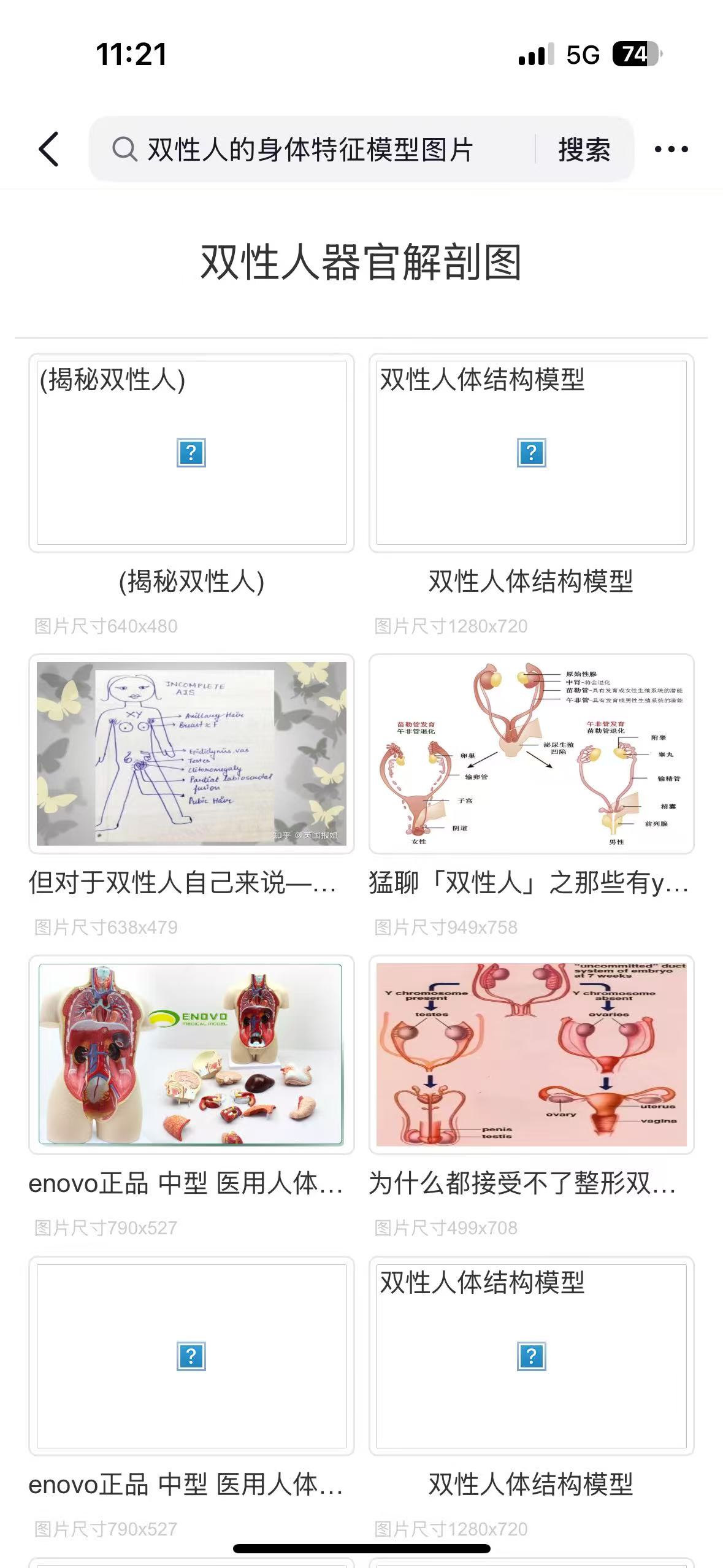孕期穿搭困扰