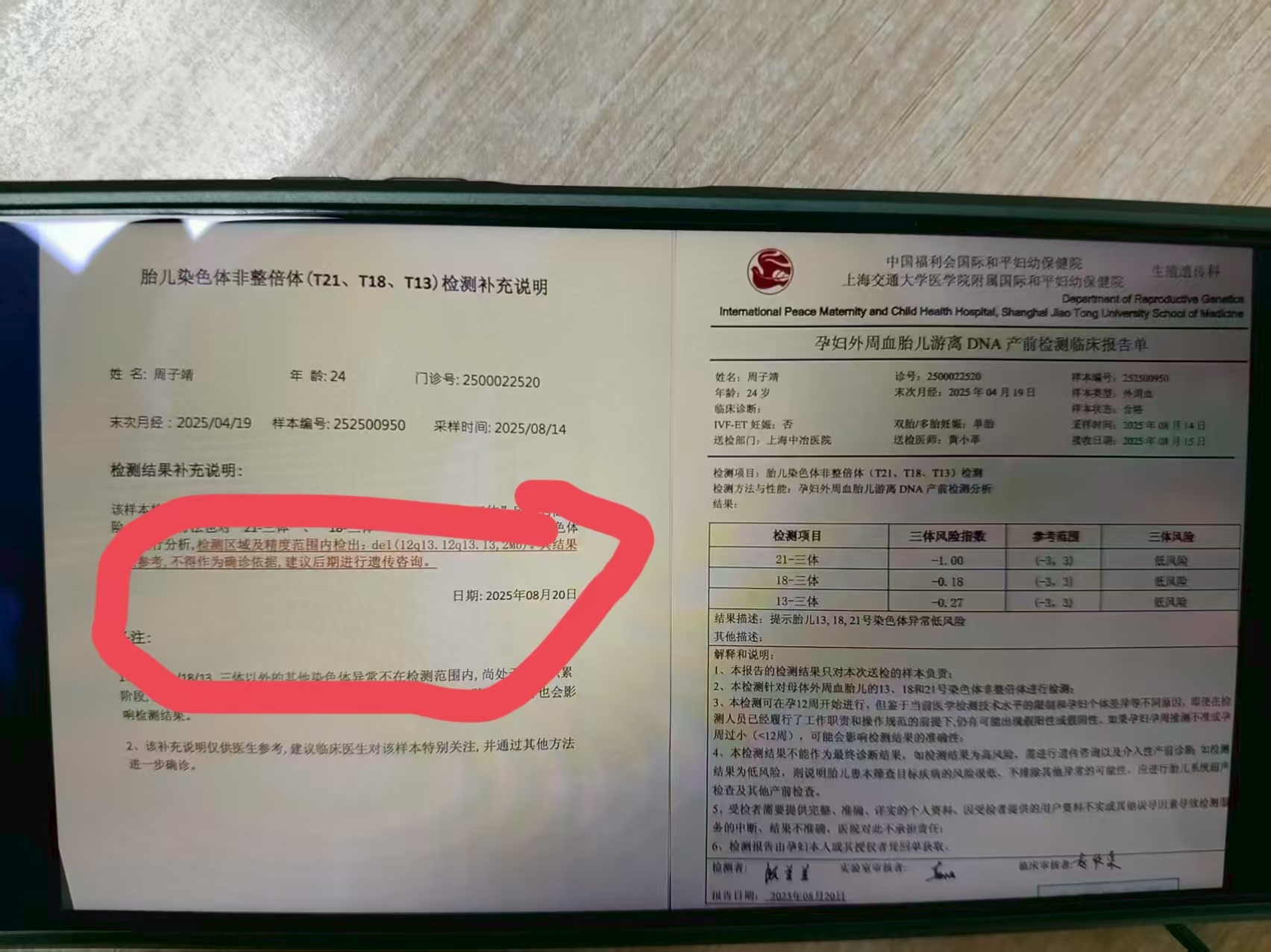 孕期检查结果异常，我该不该留下这个宝宝？