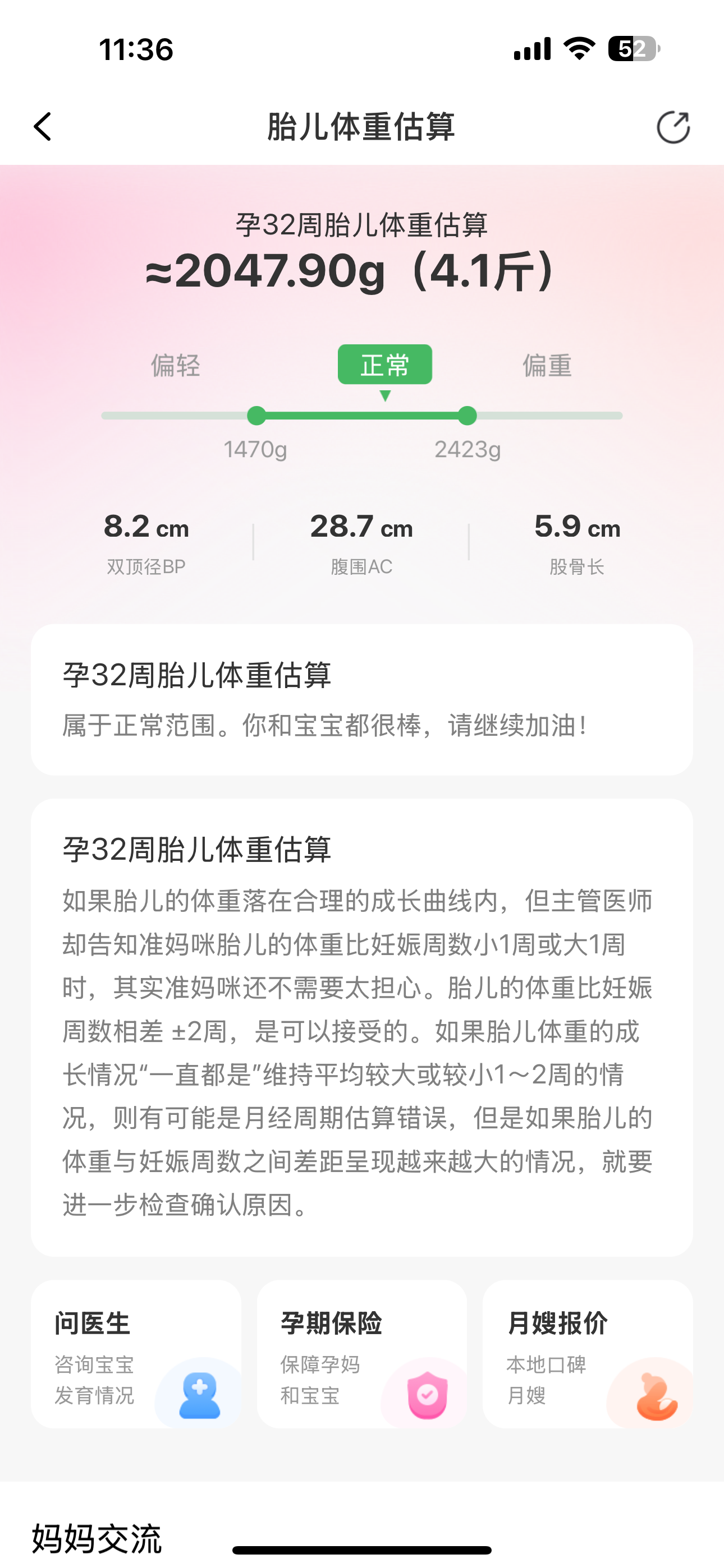 孕晚期频繁产检的烦恼