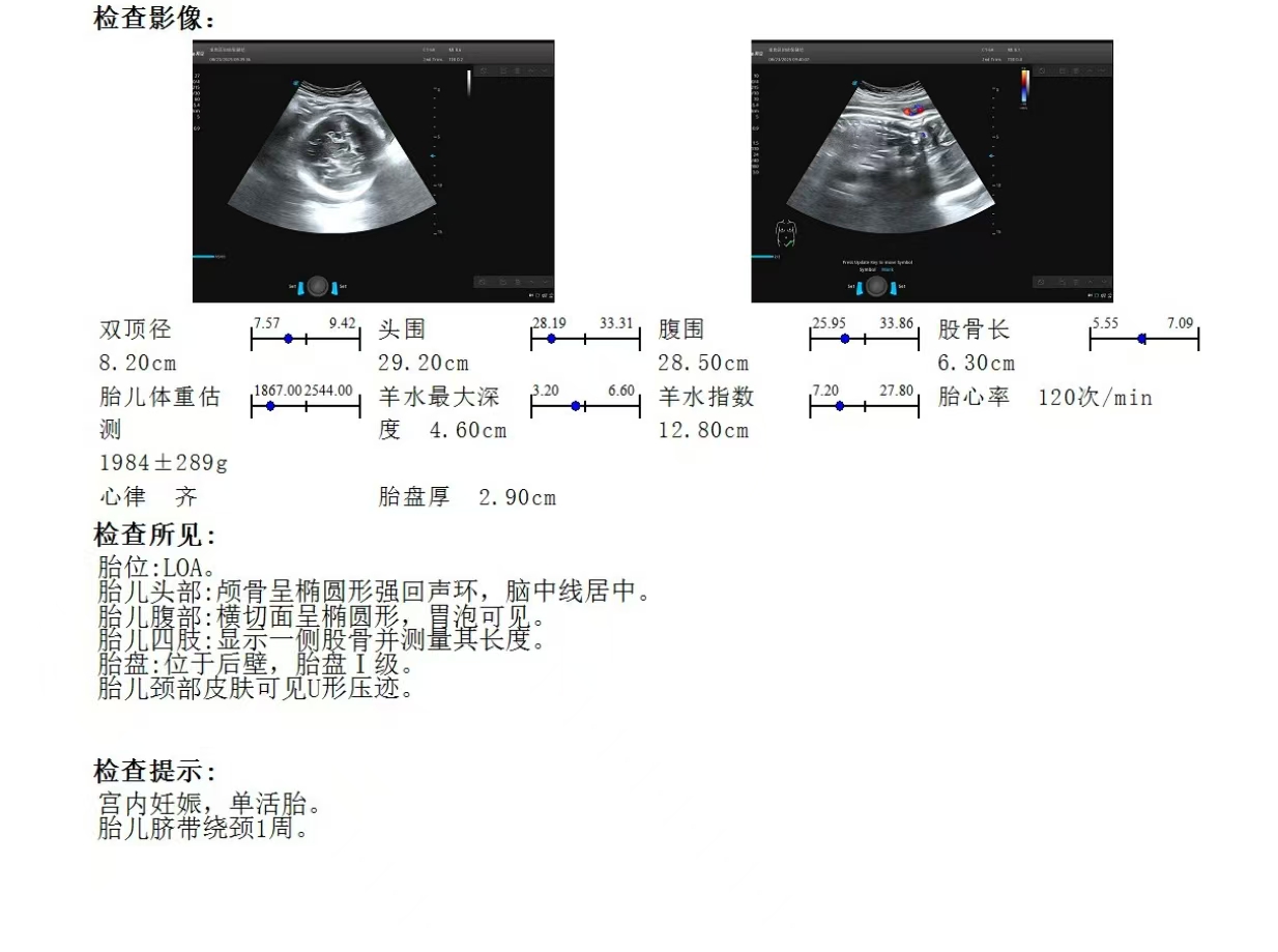 孕期失眠困扰：翻来覆去睡不着怎么办？