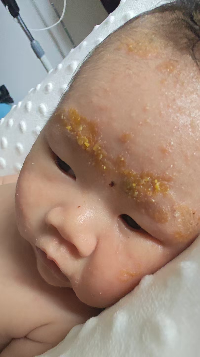 产后涨奶的痛苦经历