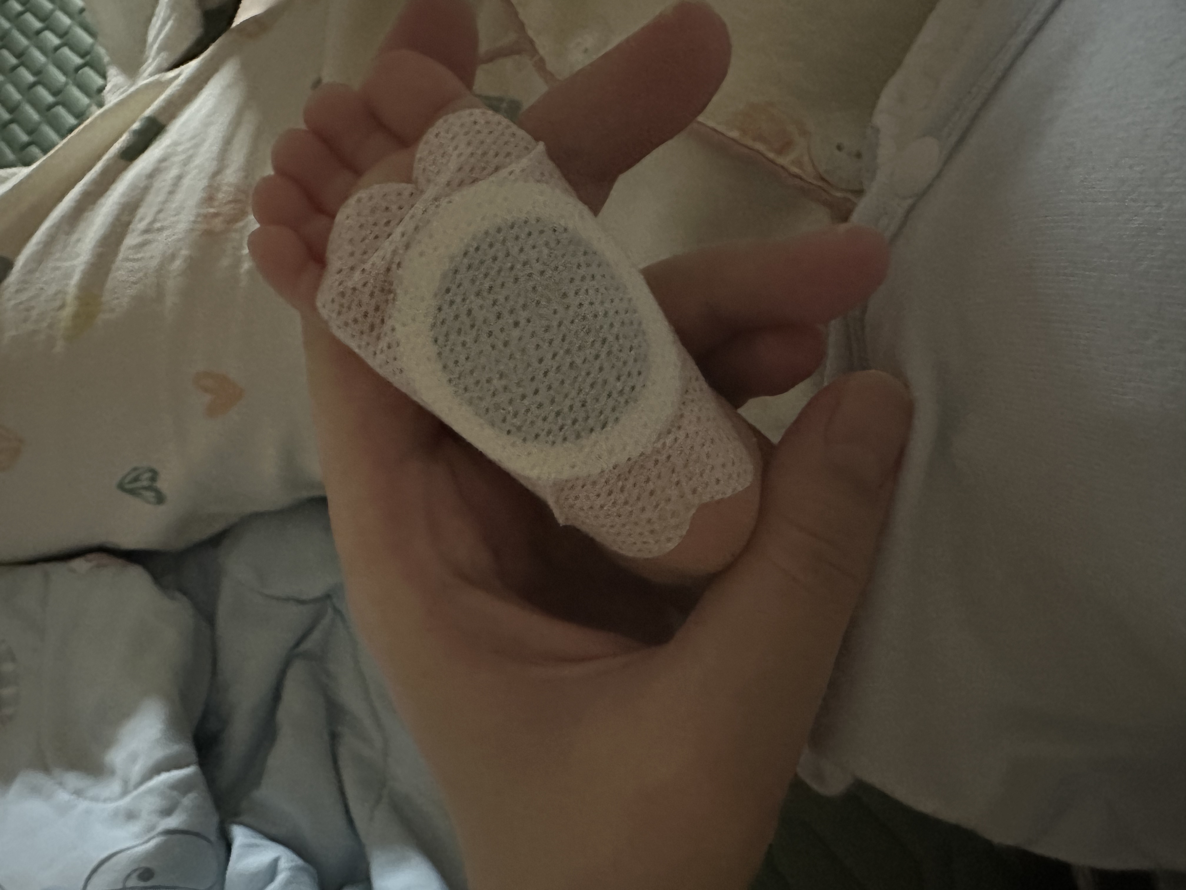 关于产后护理和新生儿脐疝的求助