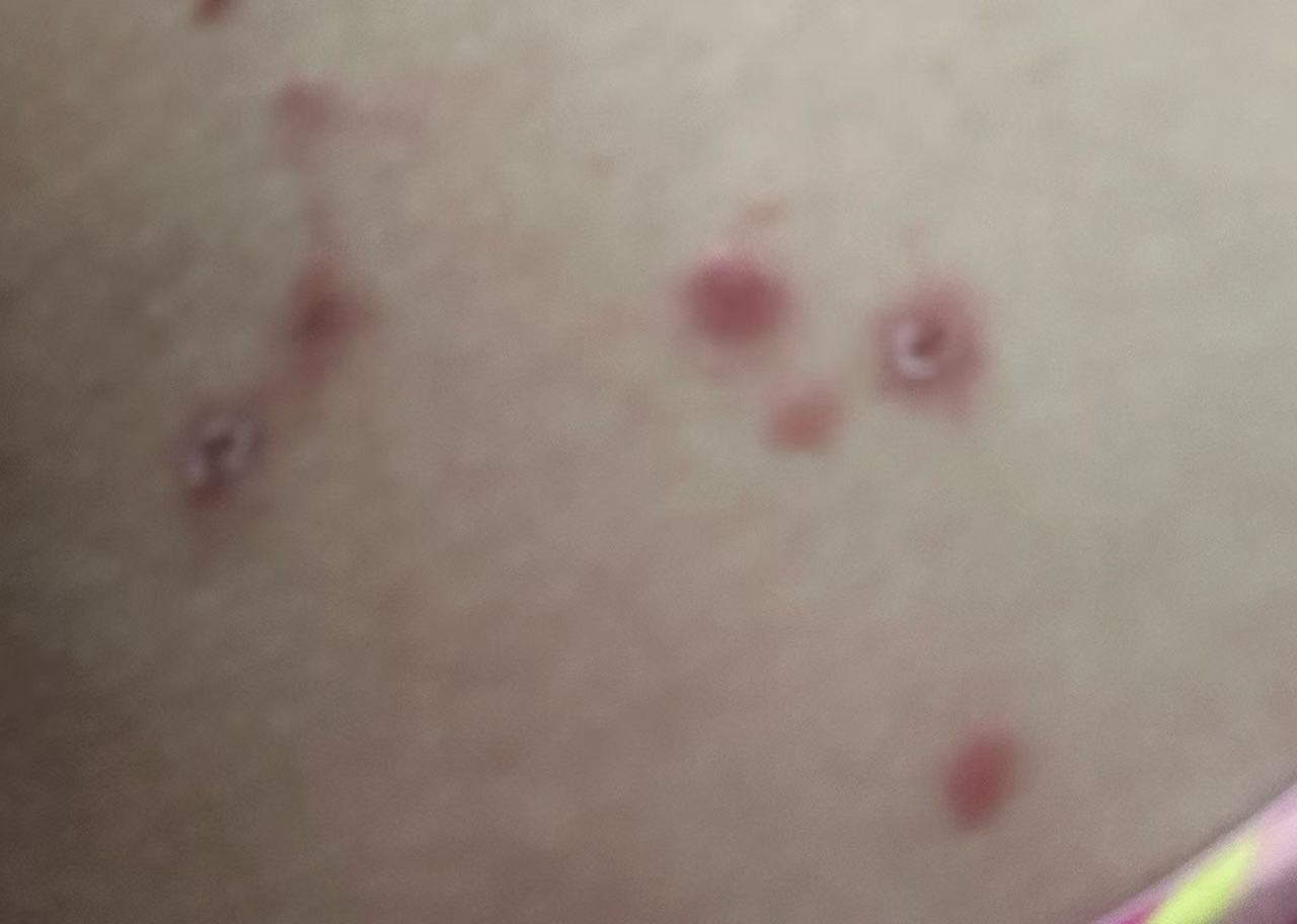产后堵奶自救经验分享