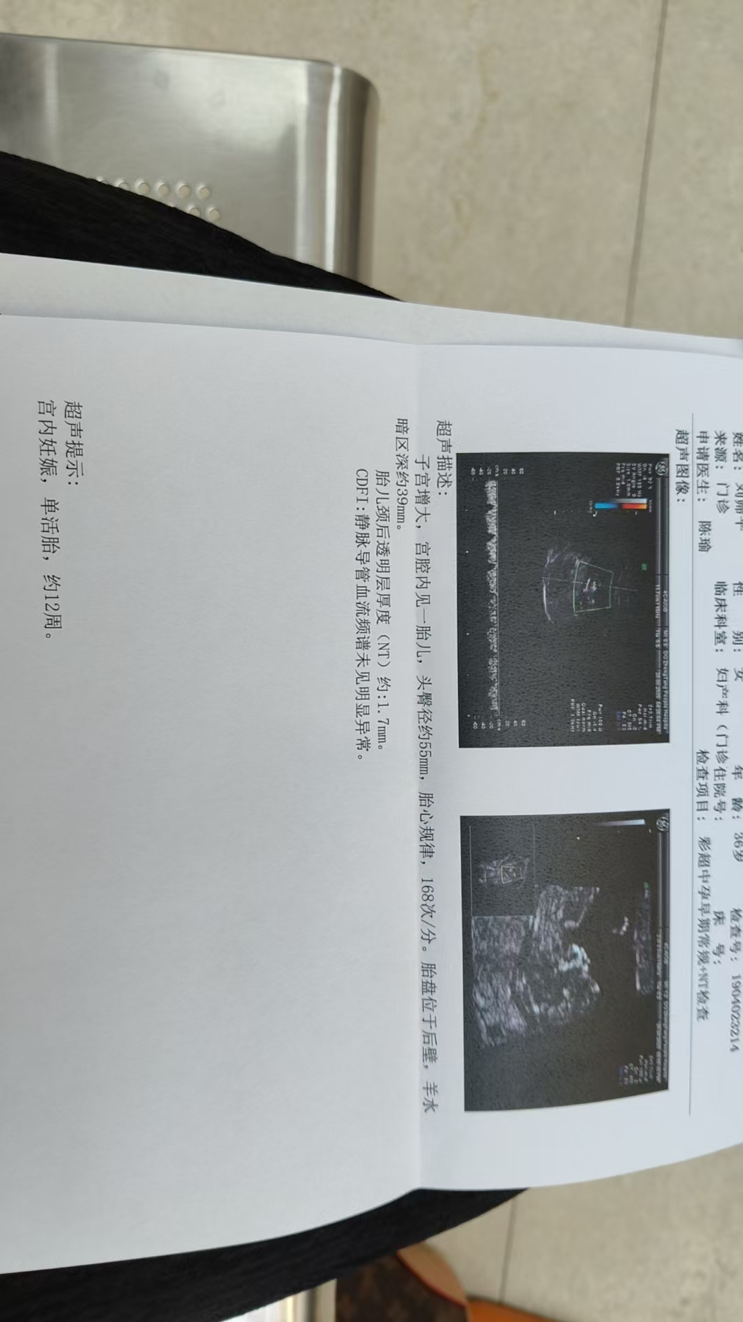 NT检查不顺利，宝宝不配合怎么办