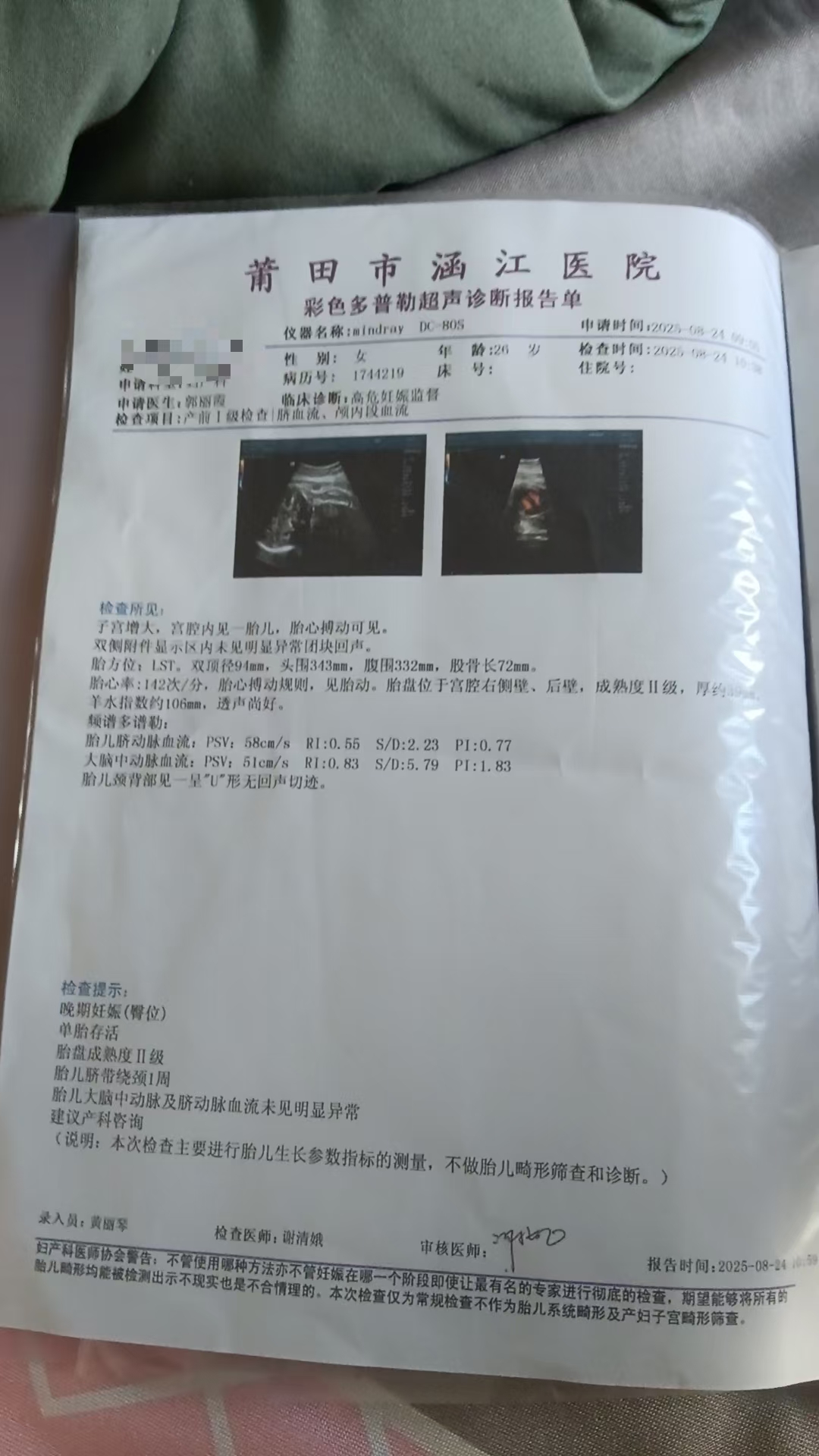 臀位顺产的纠结与担忧