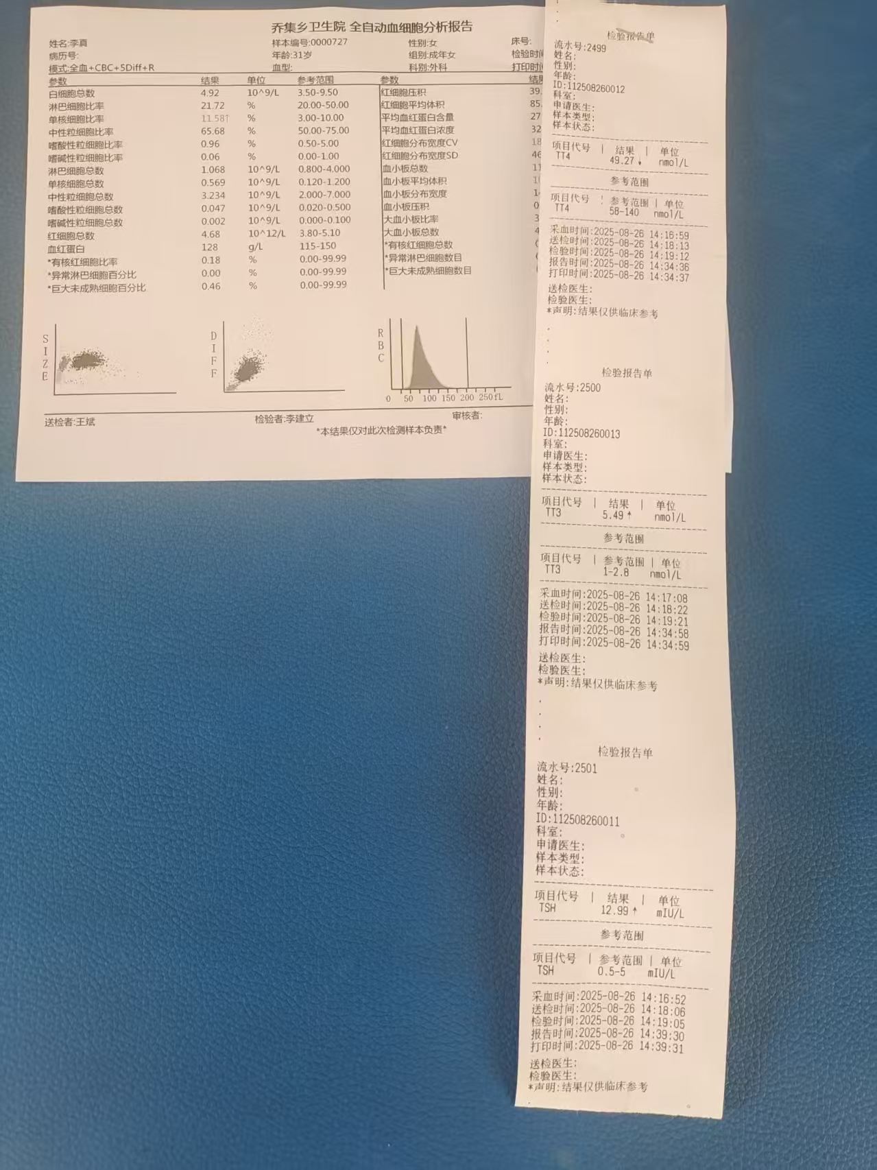 孕晚期甲状腺问题困扰