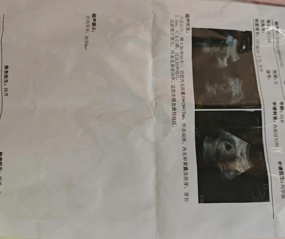孕期褐色分泌物困扰