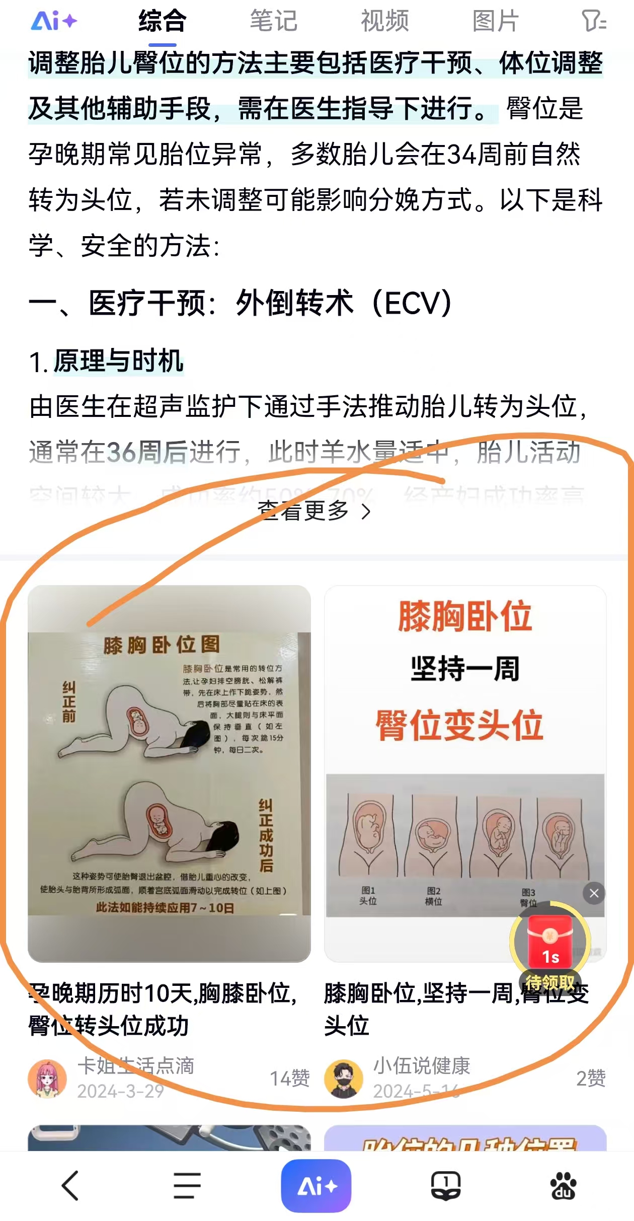 臀位顺产的纠结与担忧