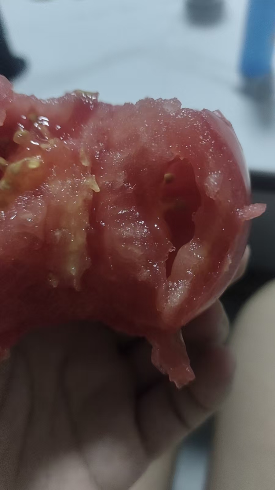 孕晚期体重飙升的烦恼