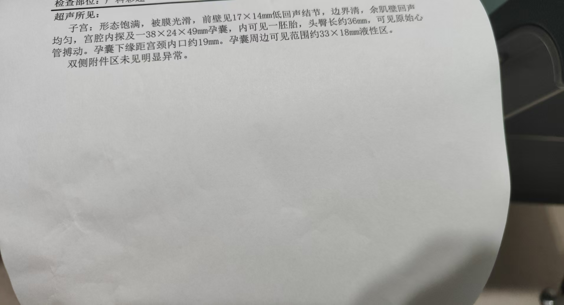 孕早期频繁检查的困惑