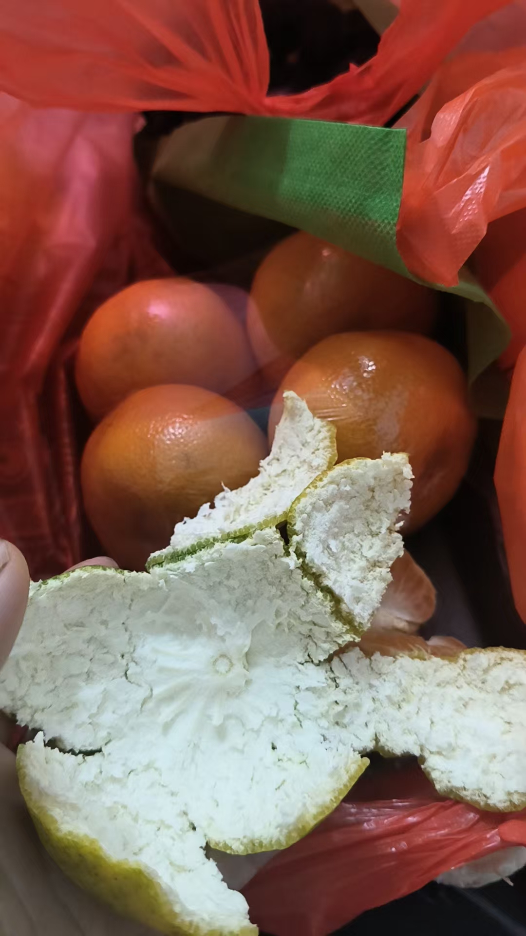 孕期不适如何缓解