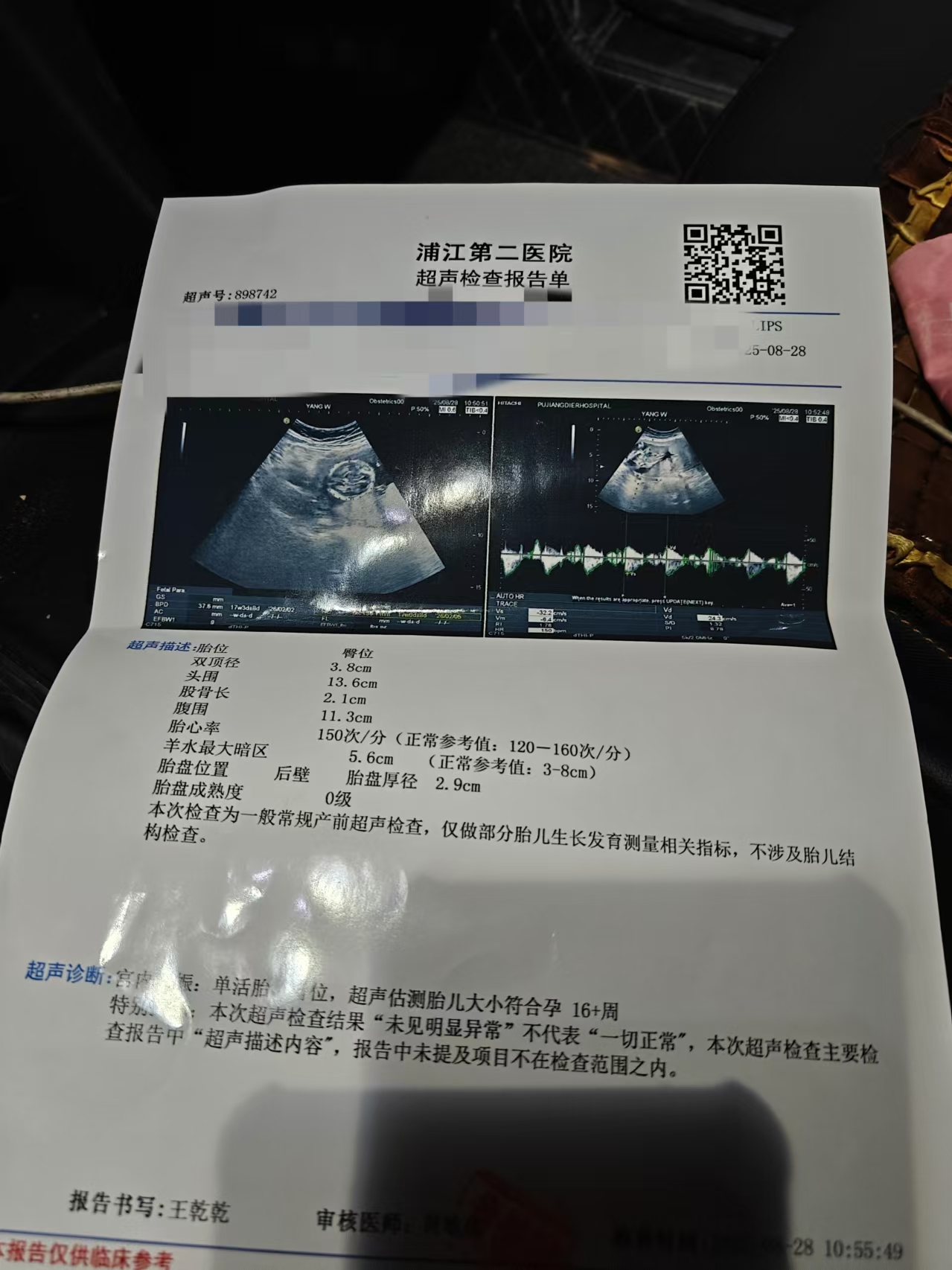 孕期胎动频繁怎么办？