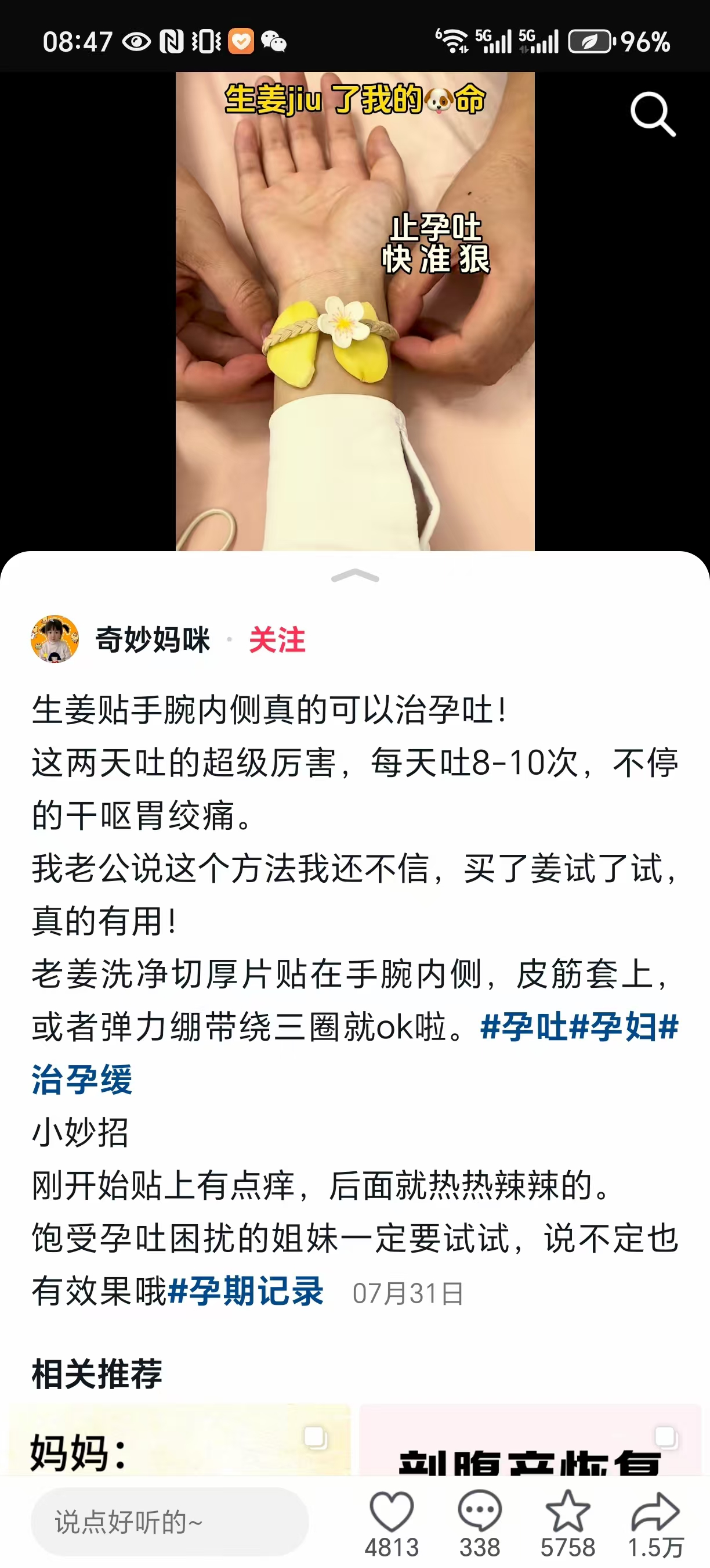 孕期失眠困扰