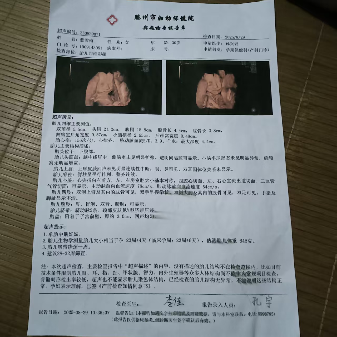 四维彩超的艰难过关记