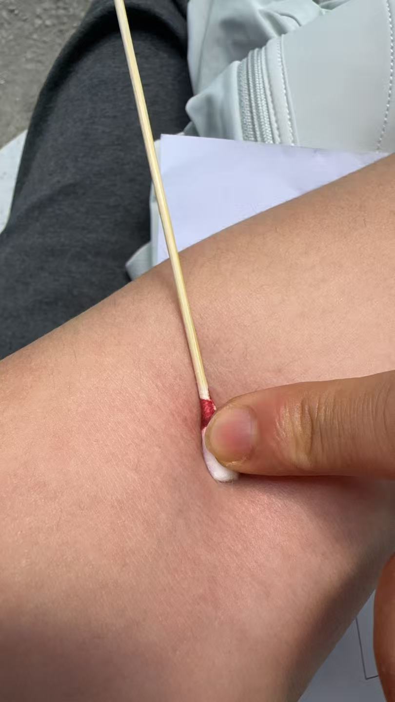孕期产检排队太煎熬