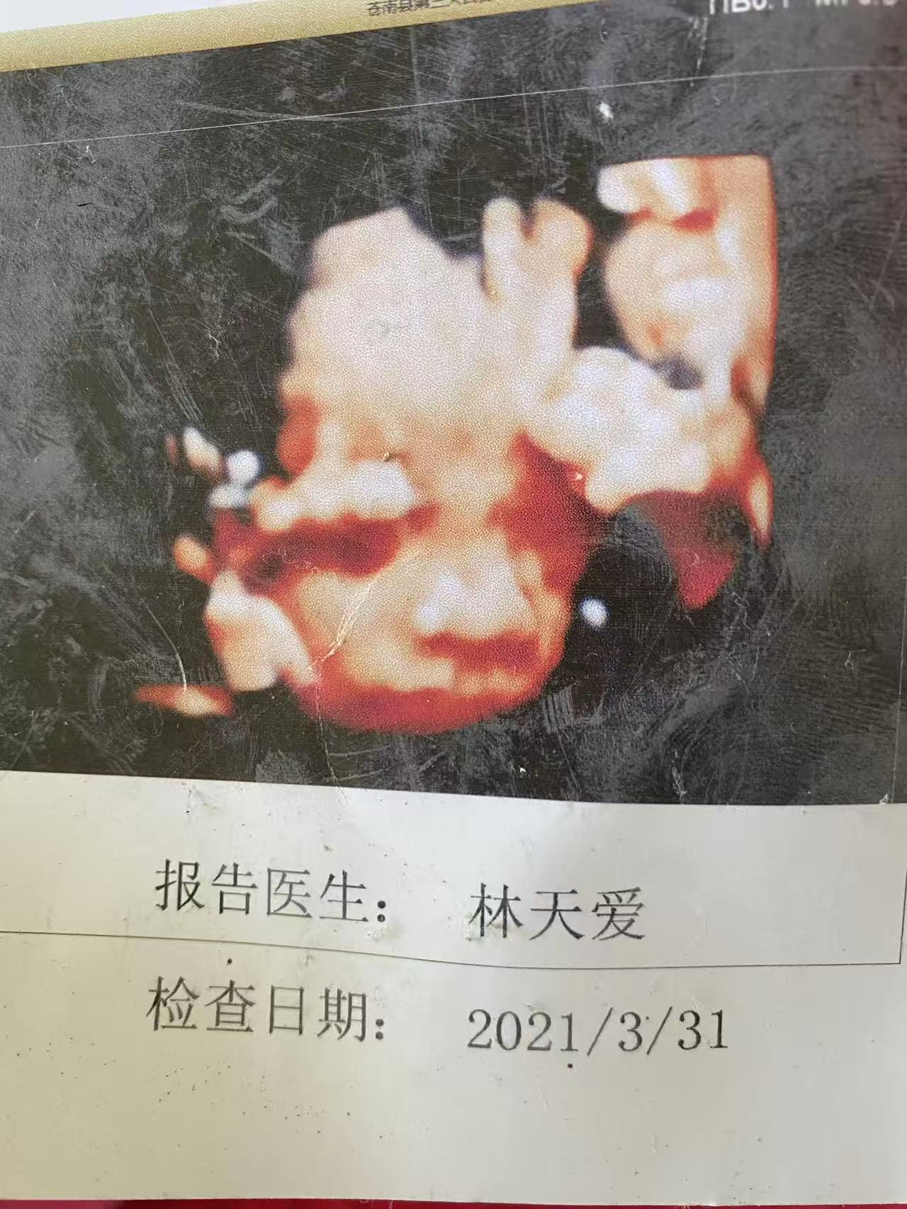 孕期夫妻矛盾引发的思考