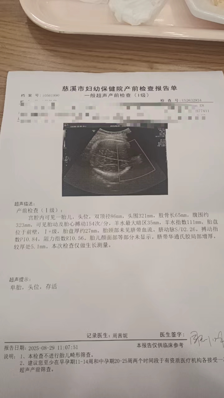 孕期产检的那些事儿