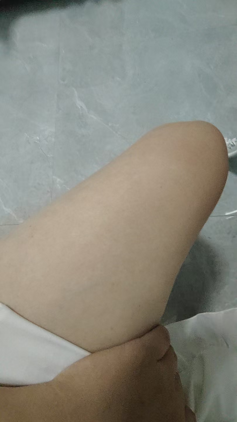 孕期体重增长的小烦恼