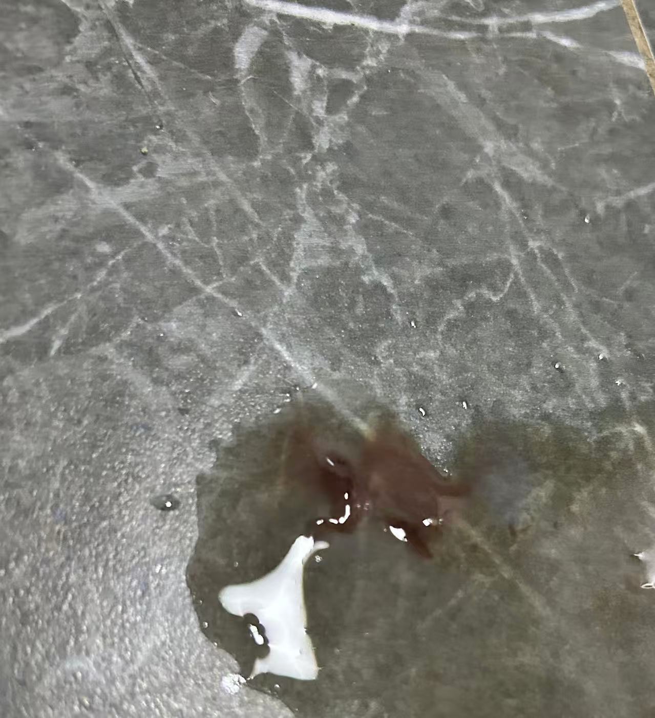 孕期见红紧急保胎经历