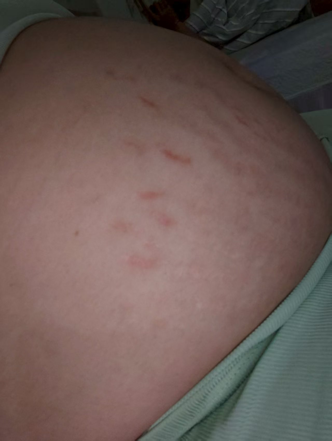 孕晚期失眠与身体不适的困扰