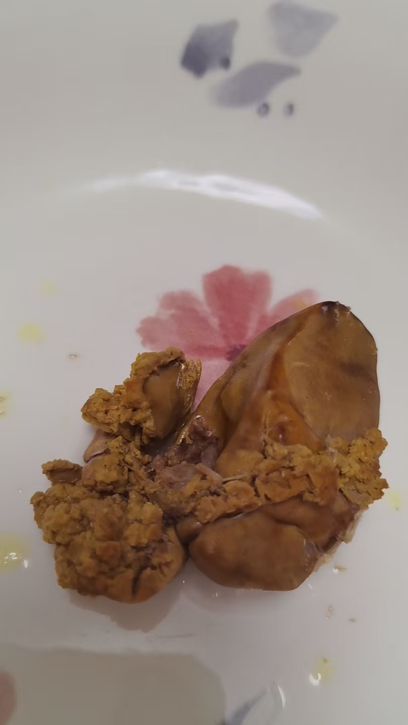 孕期体重控制与饮食分享