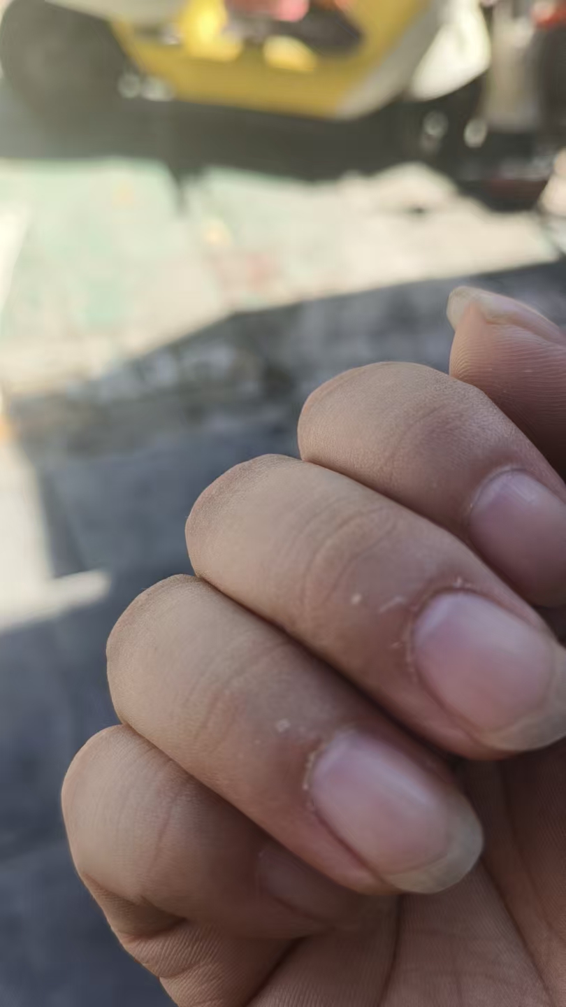 孕期营养补充的纠结：润康还是爱乐维？