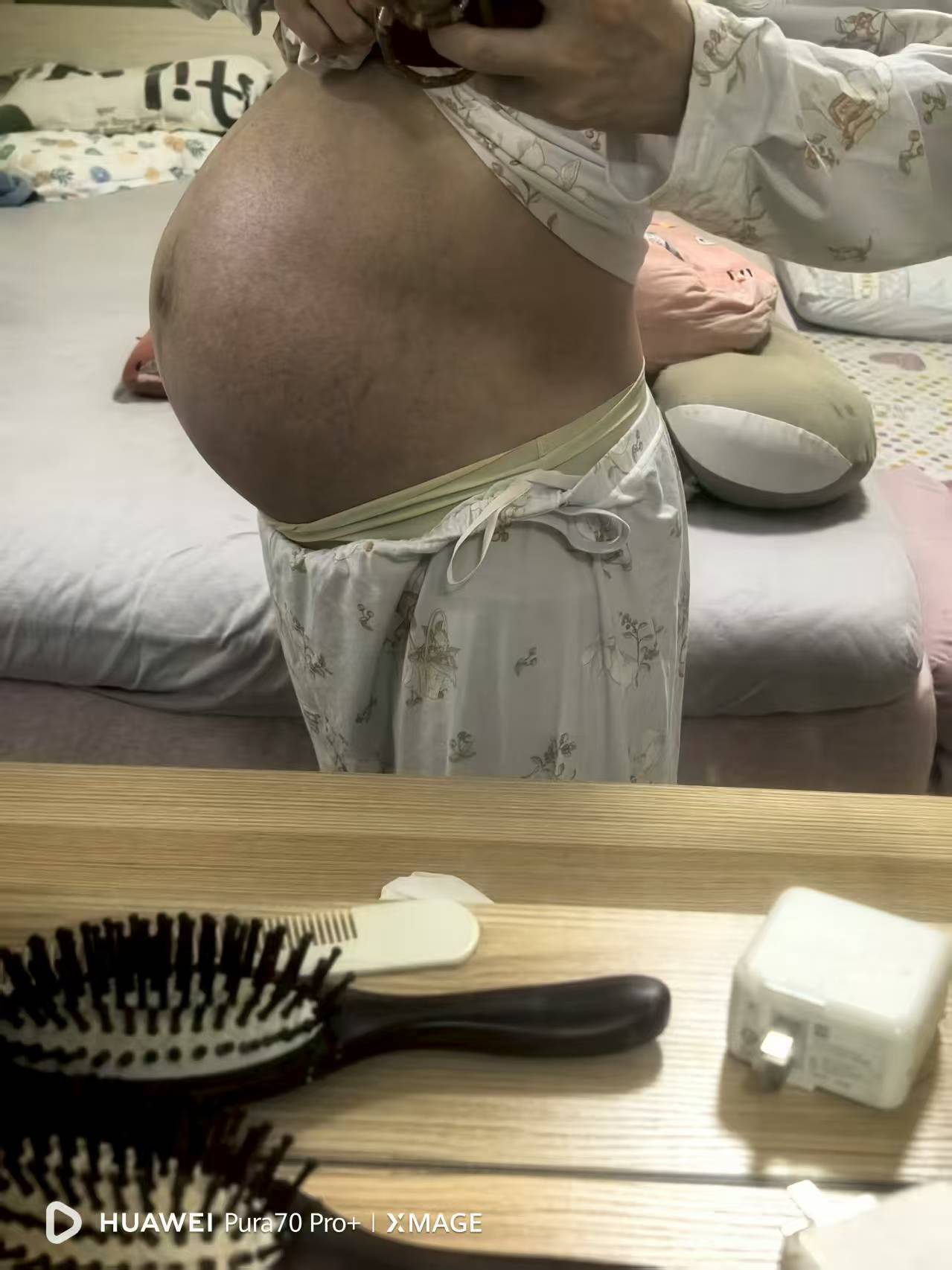 孕期腰疼是不是快生了？