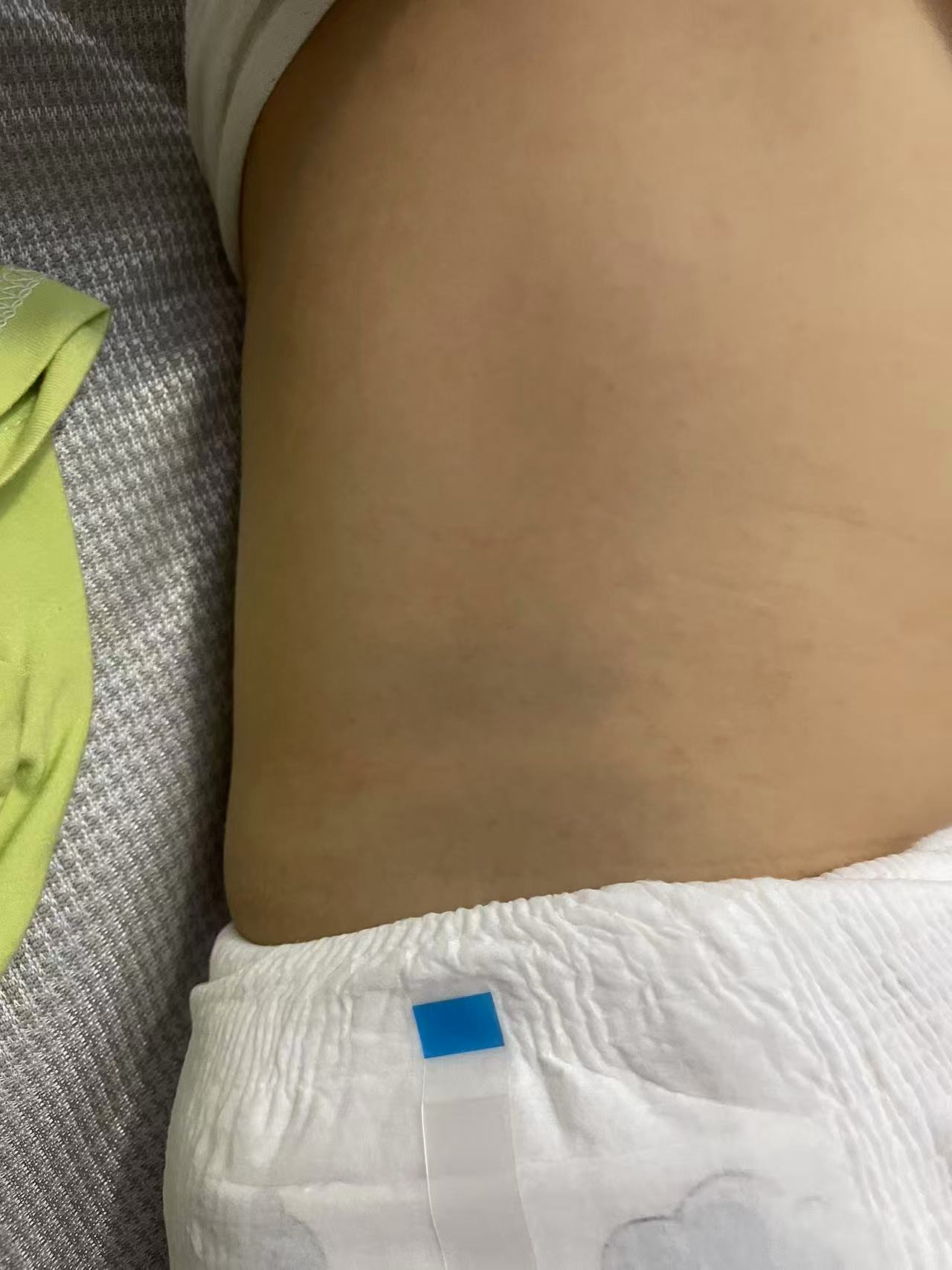 宝宝出疹子护理经验分享