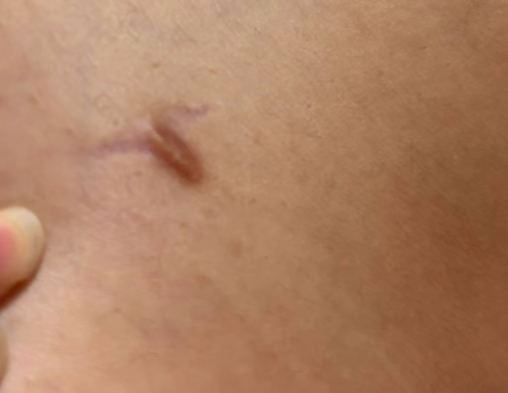 孕期口腔护理经验分享